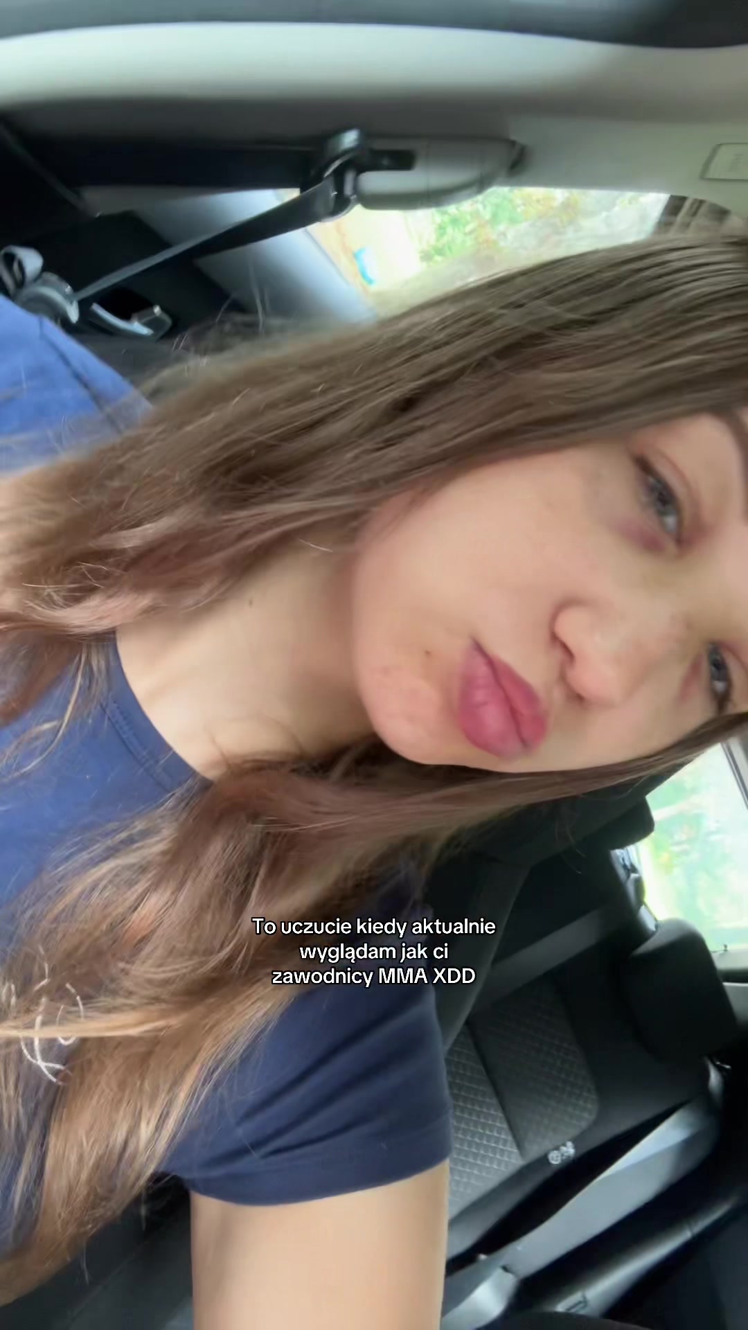 @R&oslash;xa💕