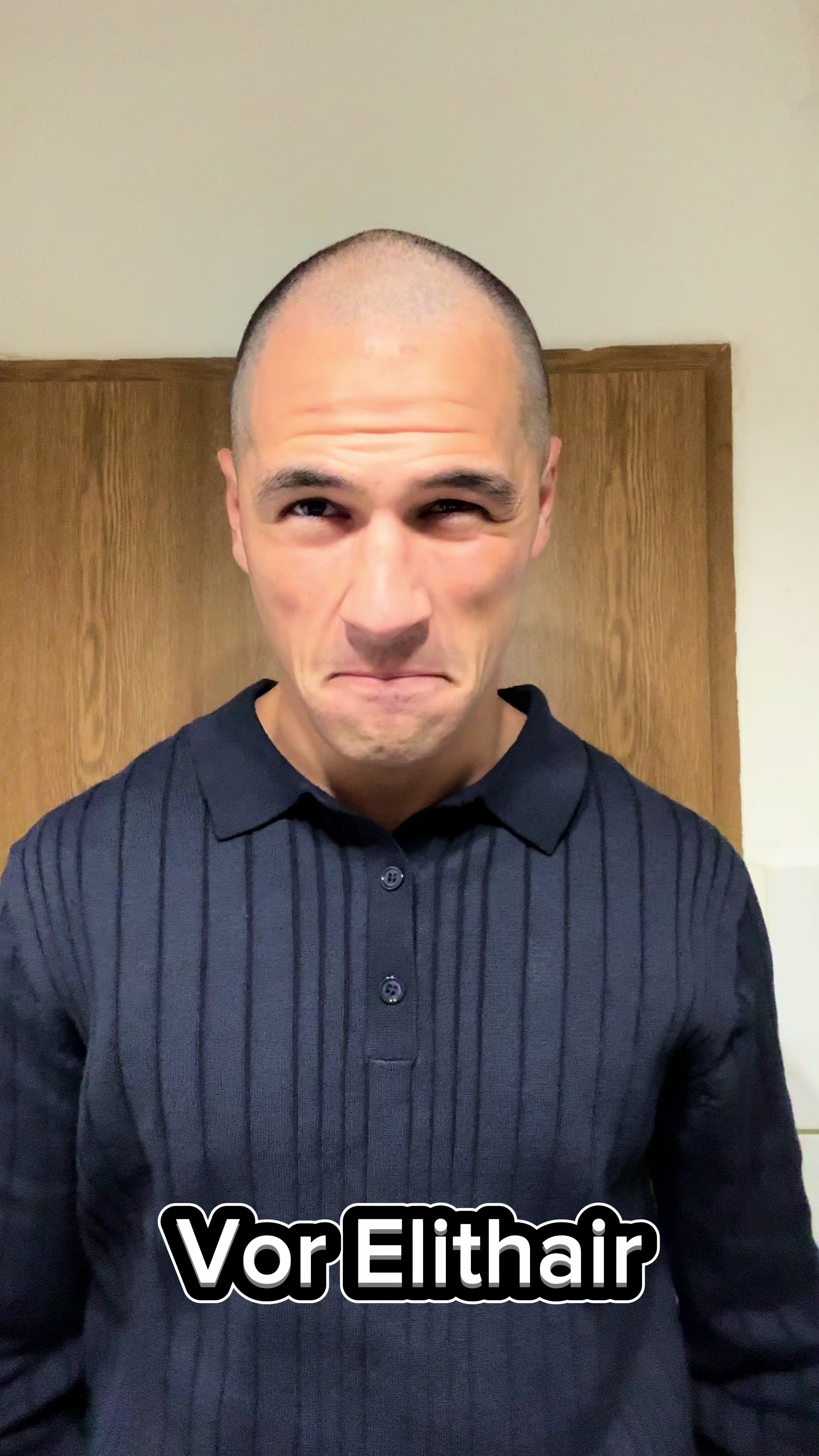 @Edward Dönmez