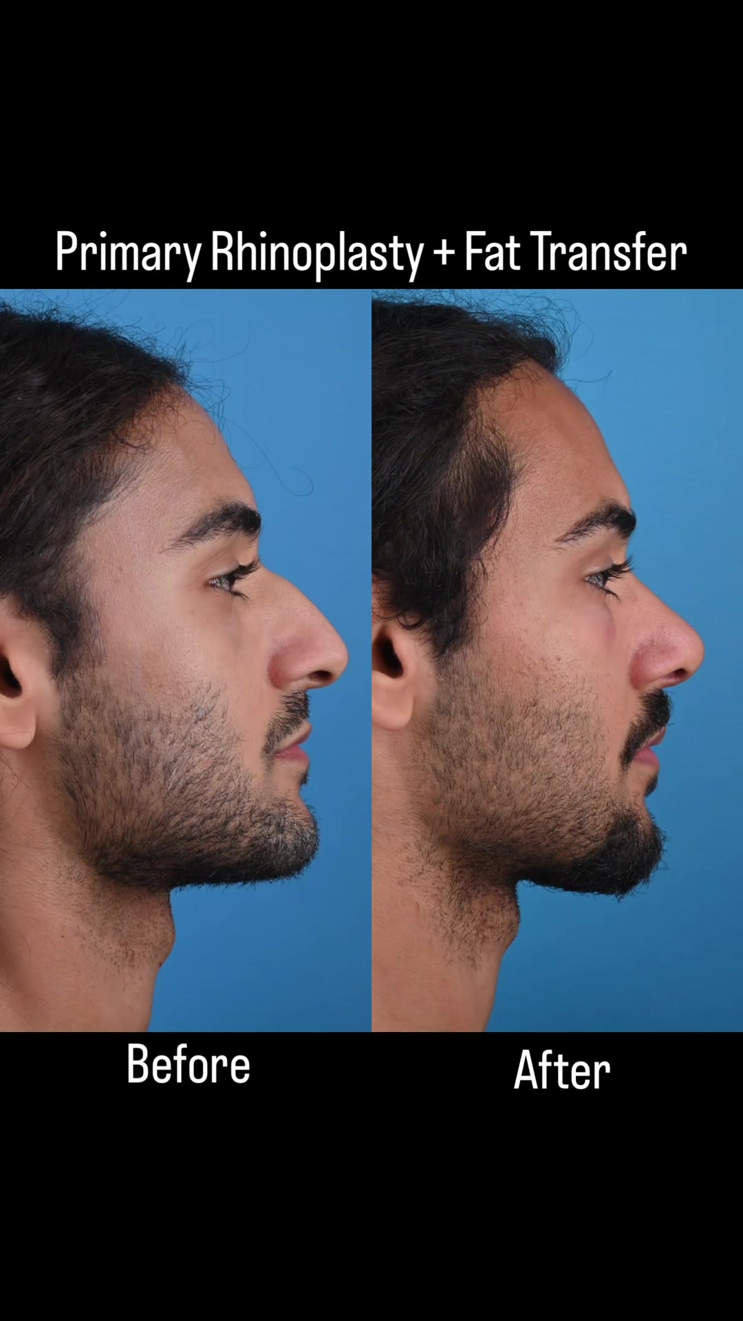 @Dr. Parit Patel, MD