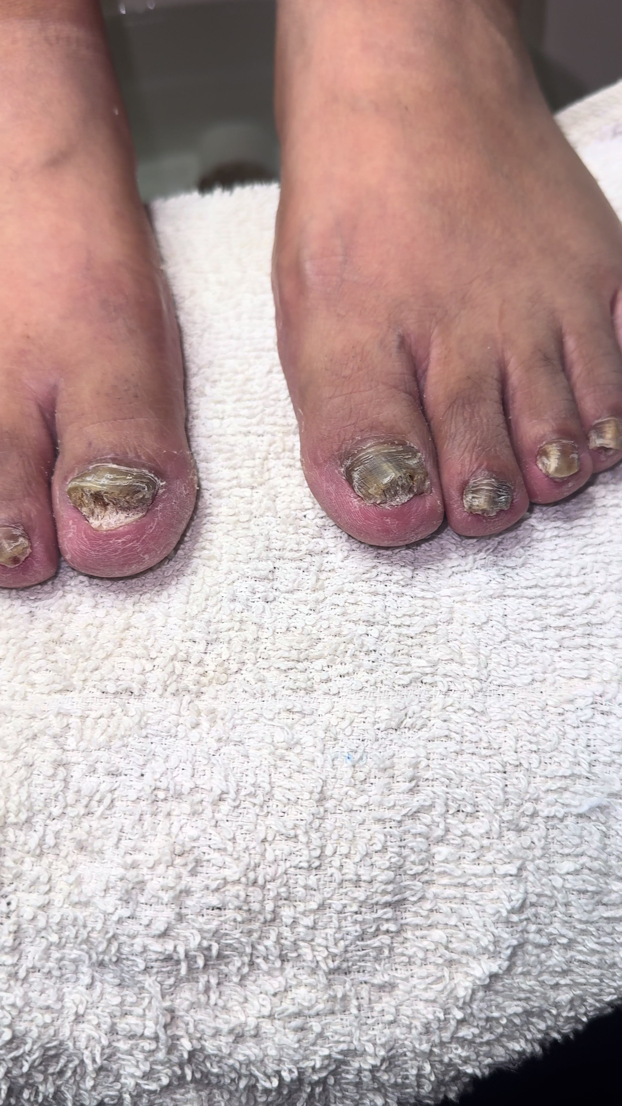 @ToesbyKoki