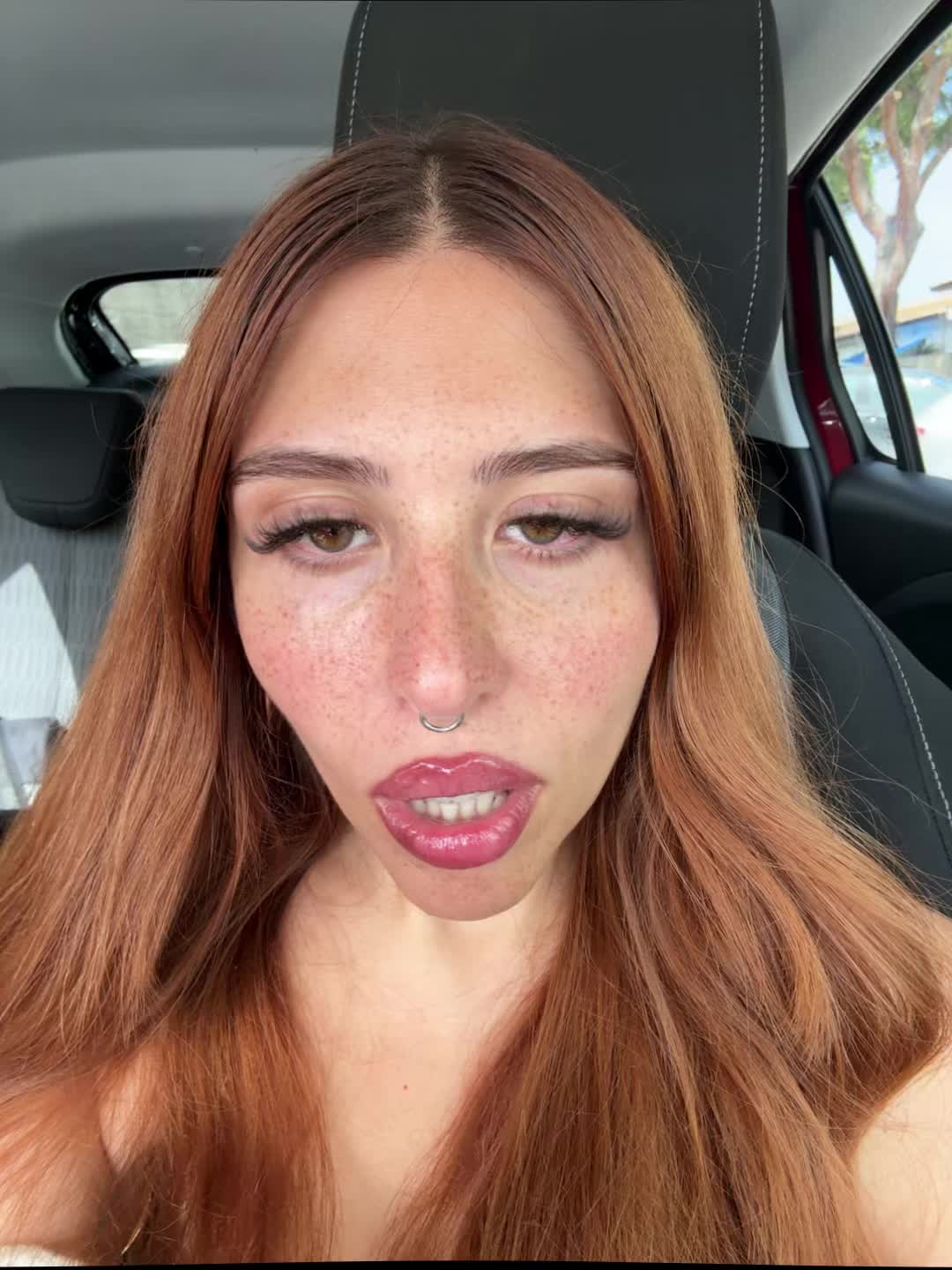 @ketoprophede