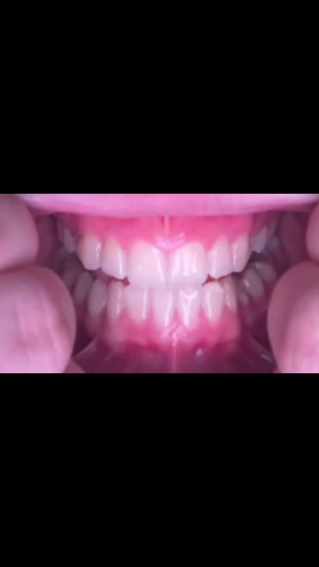 @teeetharecool