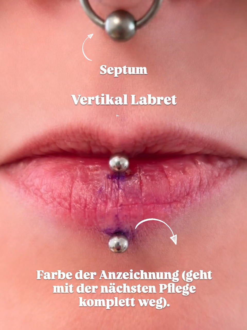 @Stephi von Durchstich.wzbg💉🩸