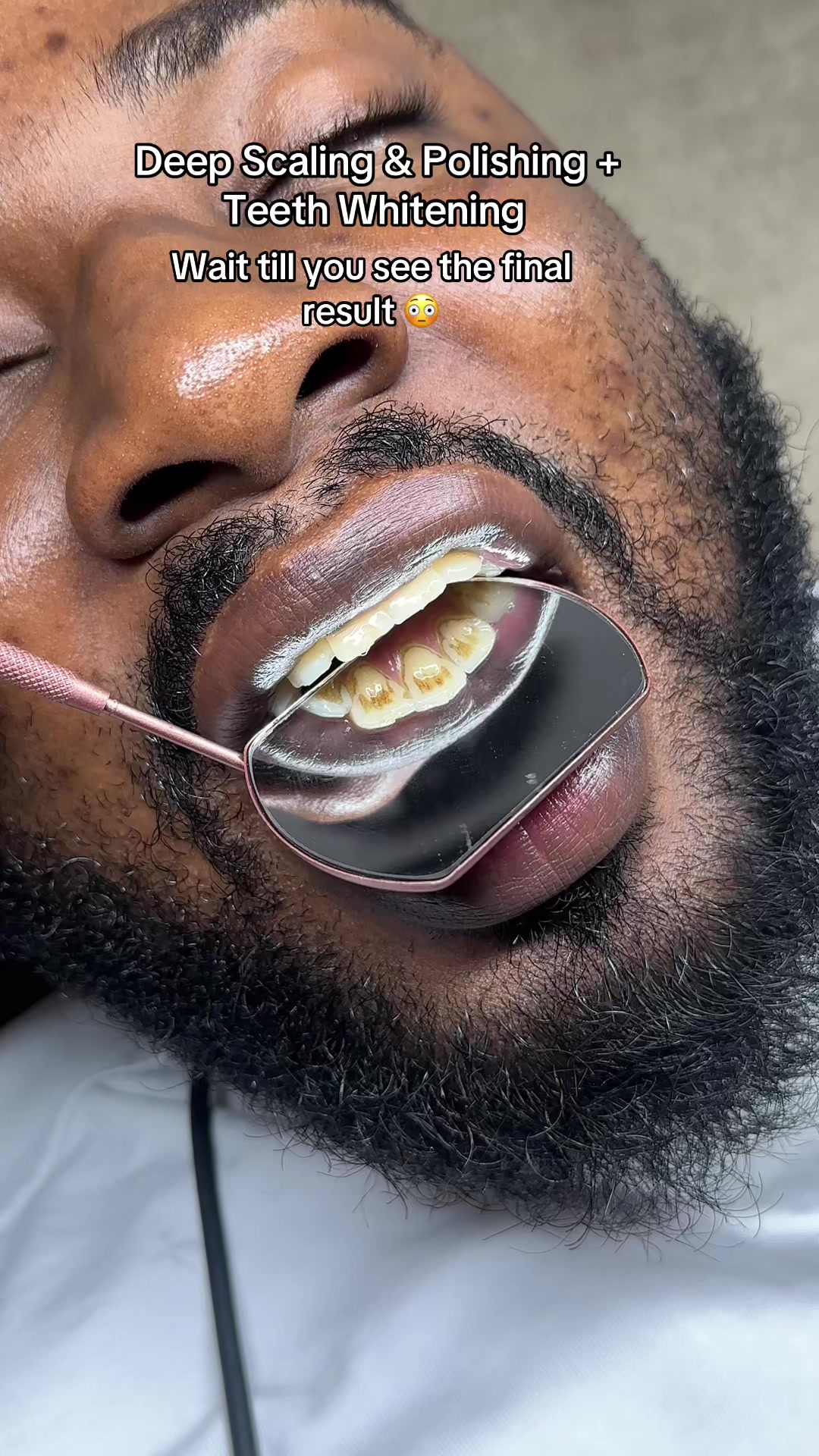 @AGO PALACE LASH&BRACES ARTIST