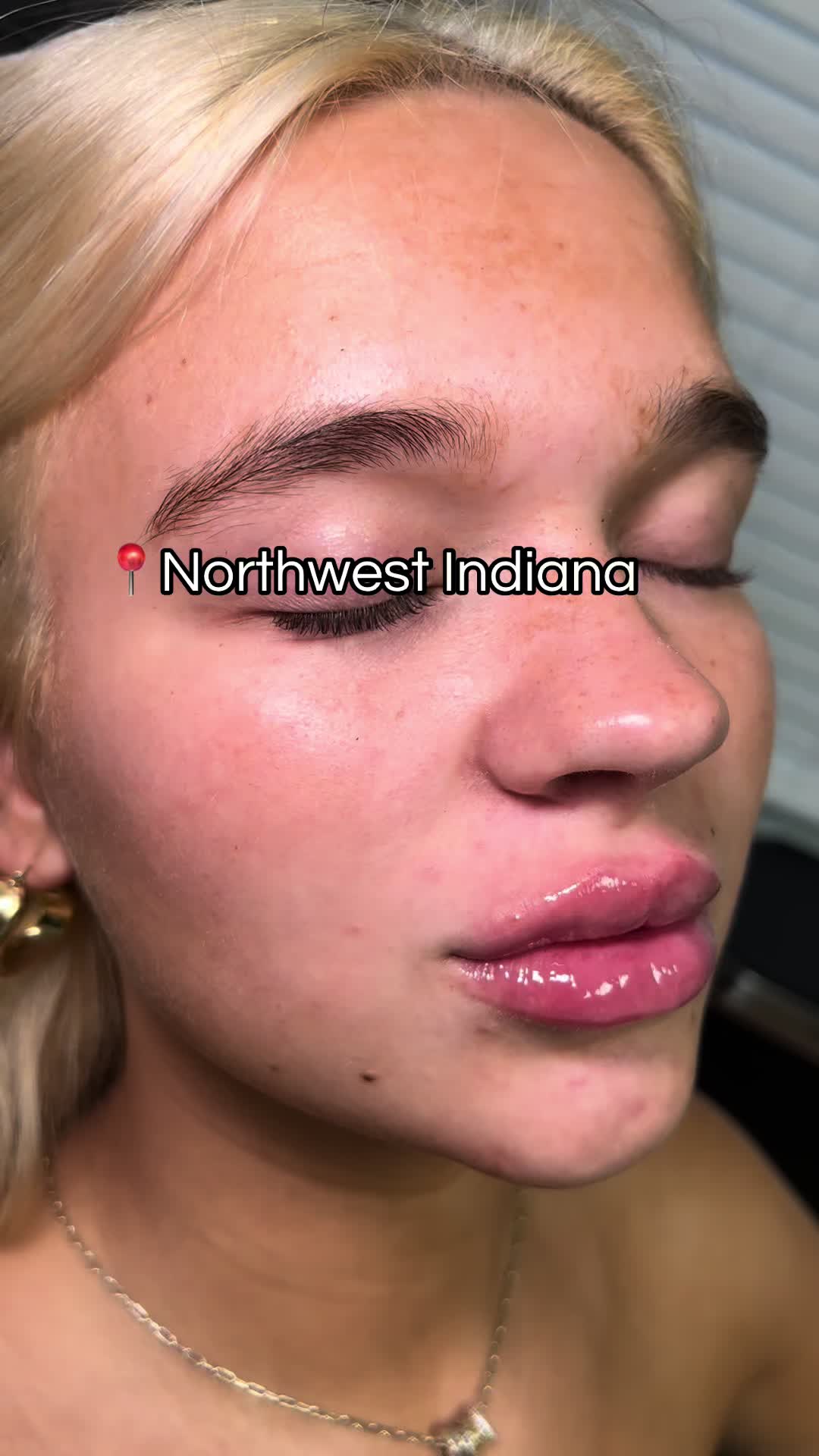 @Christy - NWI Aesthetic NP