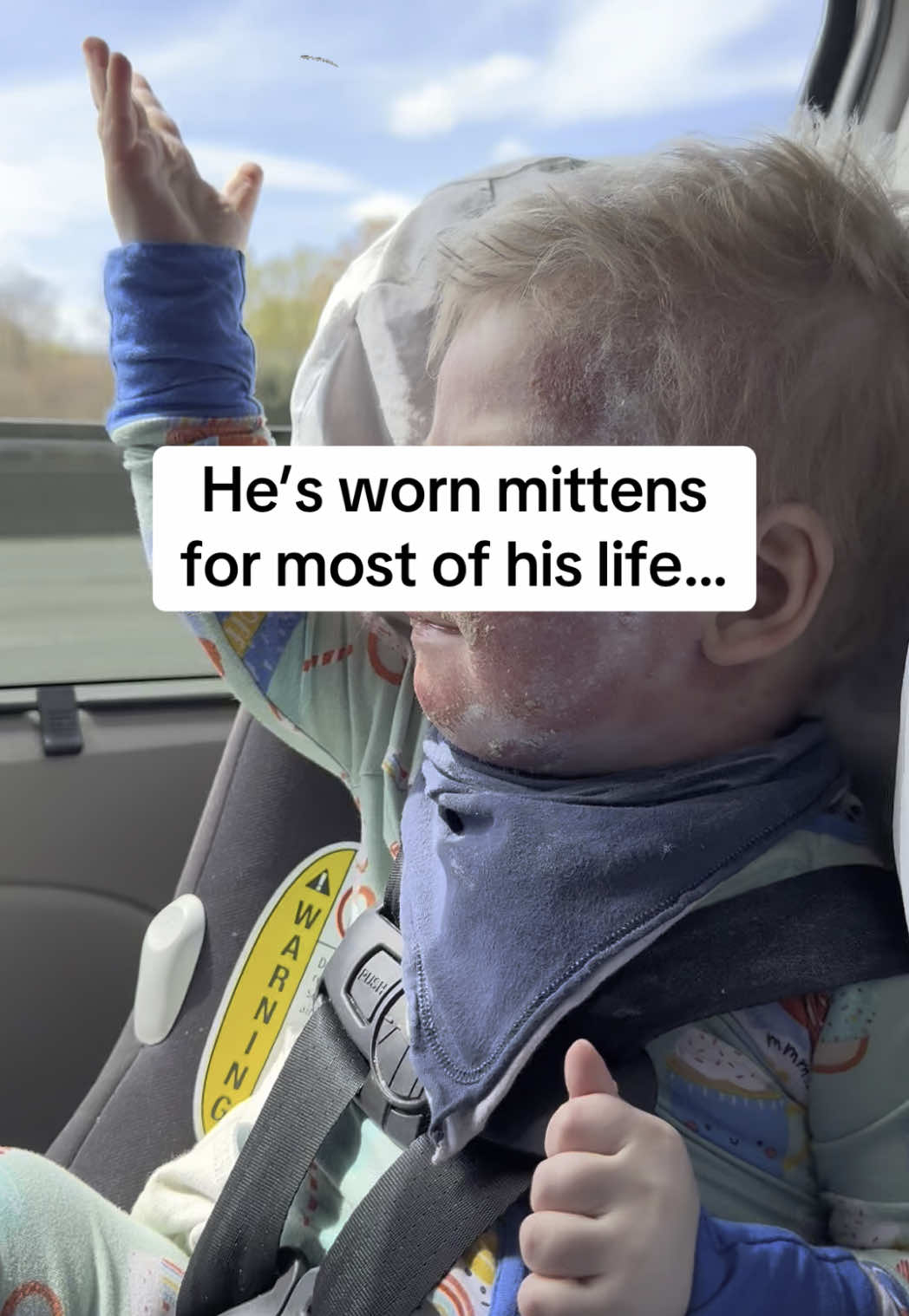 @Eczemama