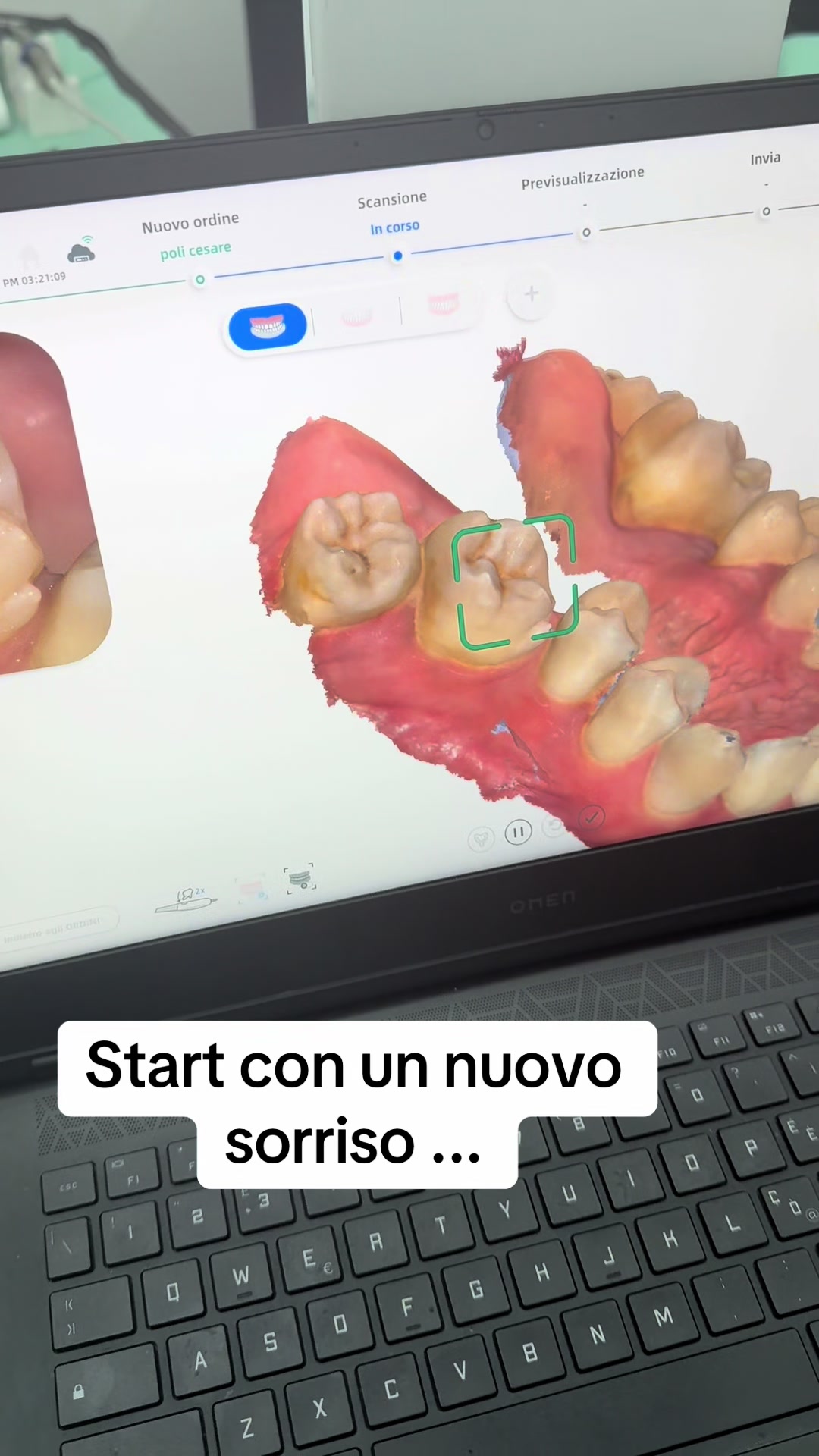 @Dott.RaffaeleNegro 🦷