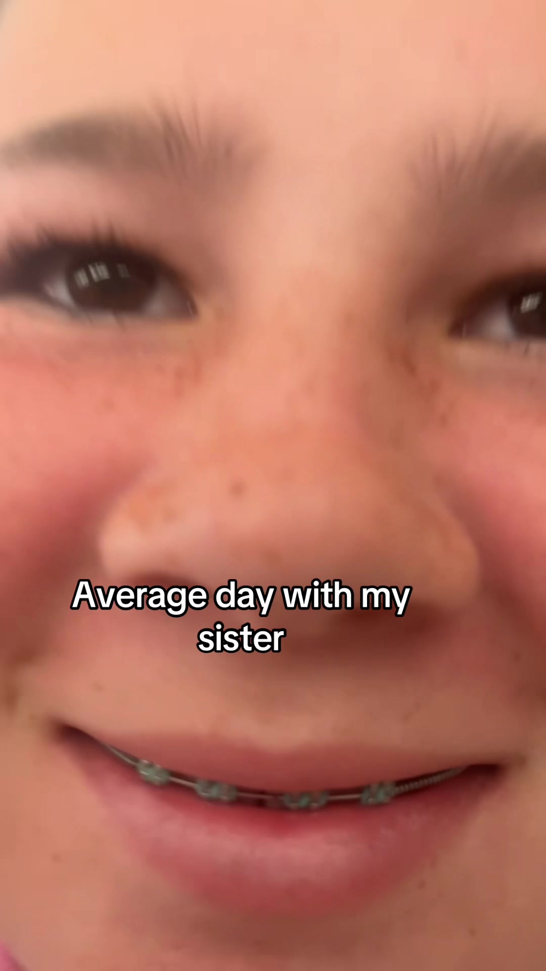 @Skid.Mark