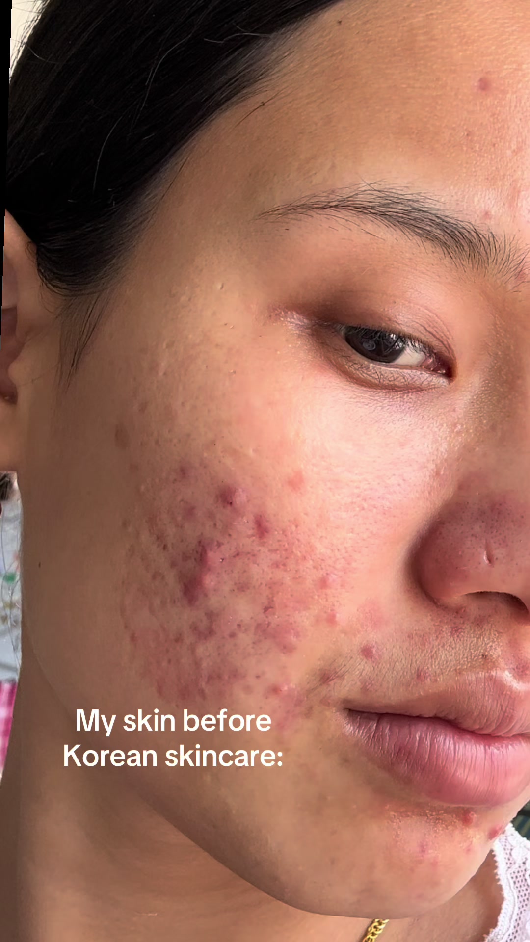 @Styleandskinbysanju