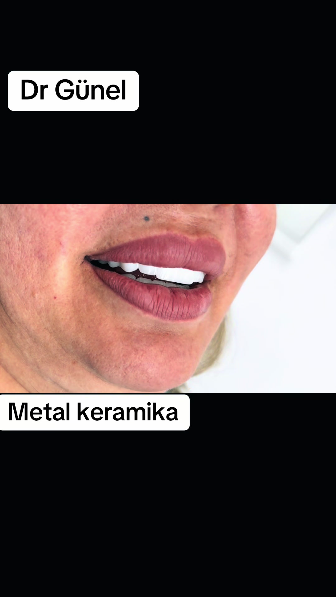 @Dentist_G&uuml;nel