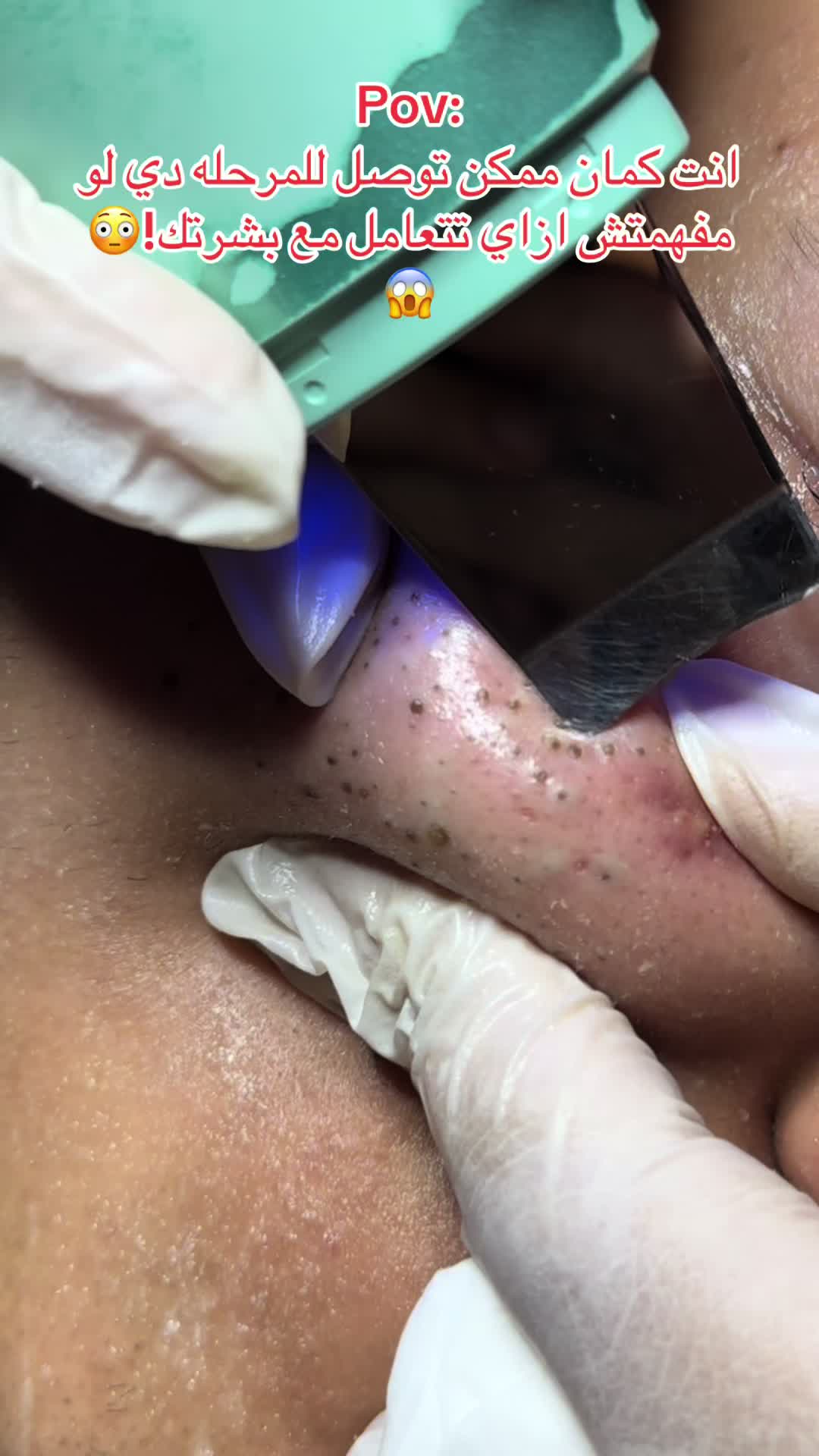 @menna_skintherapist