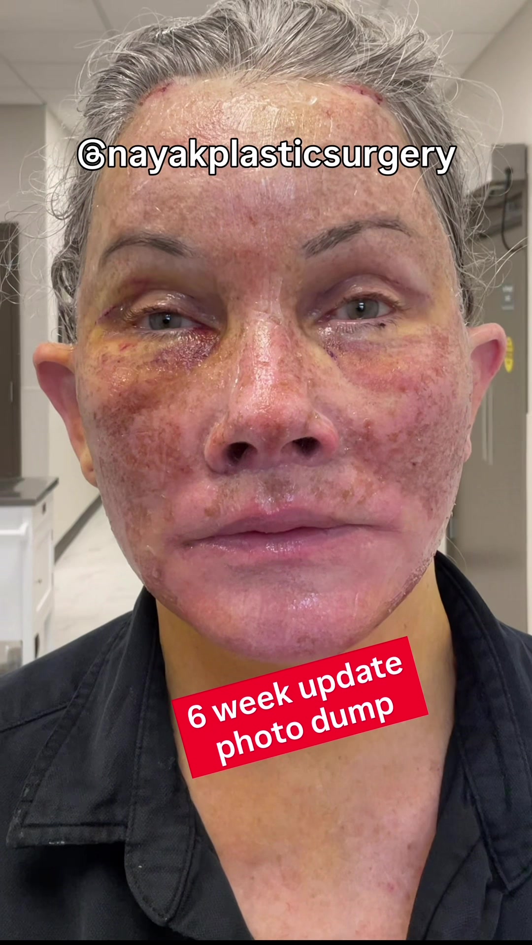 @NayakPlasticSurgery