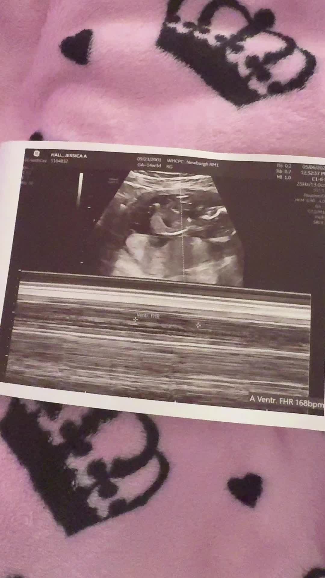@Jessticles 💕🥰