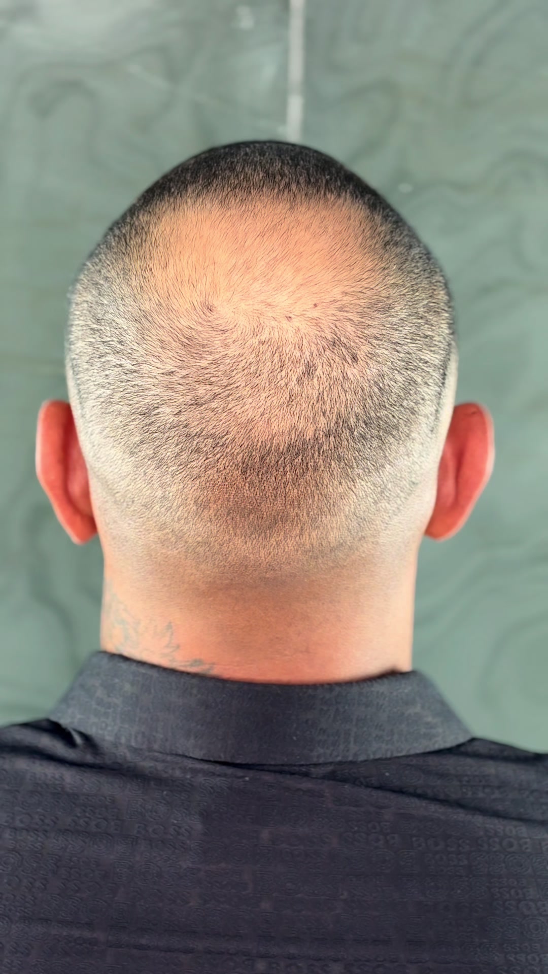 @Valesca Abi Ackel Scalp
