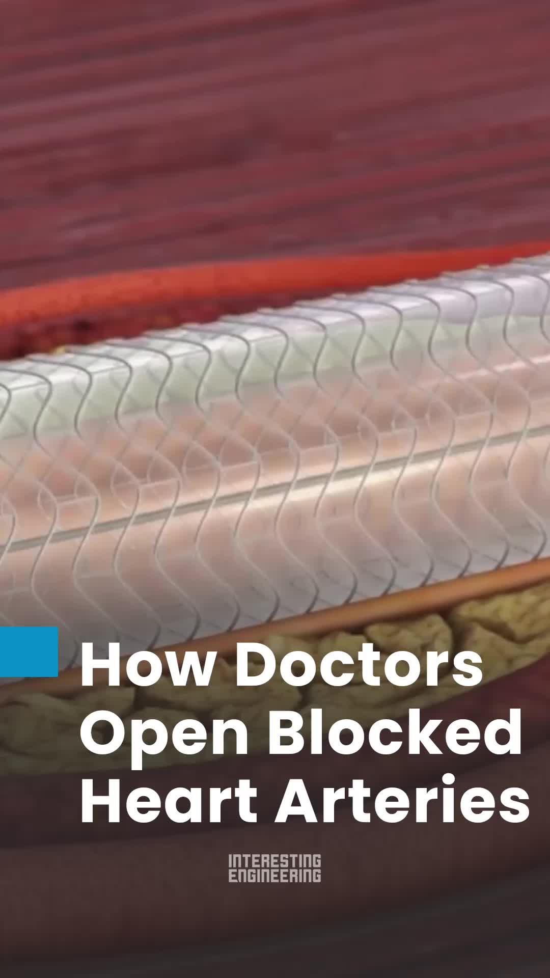 @interestingengineering