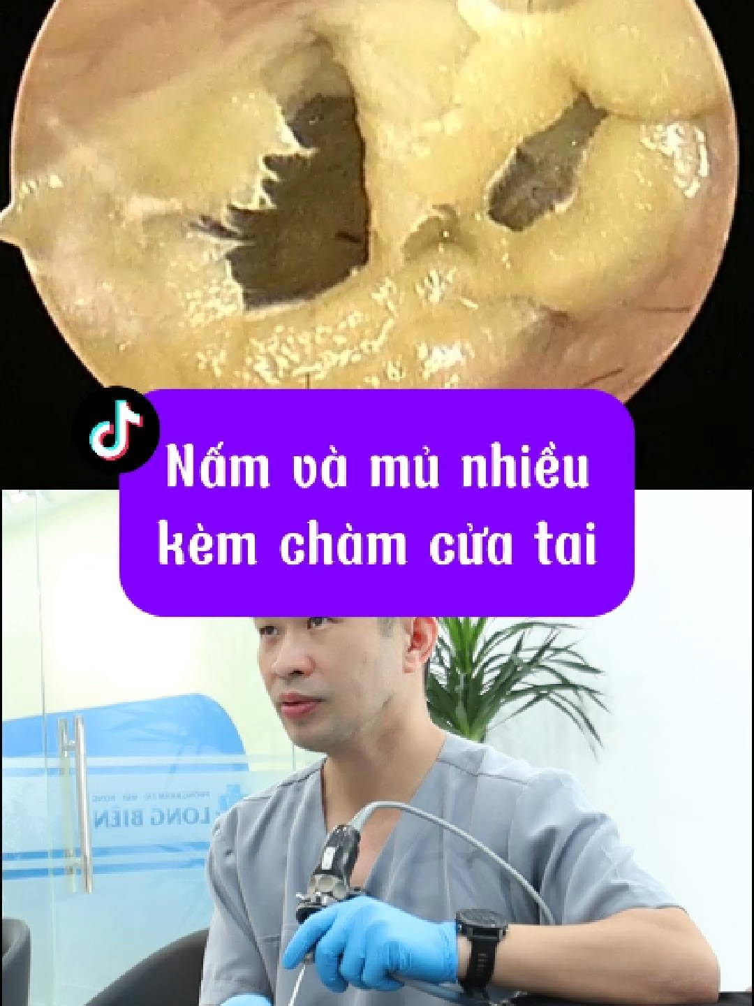 @Bs Hiệu Tai Mũi Họng Long Bi&ecirc;n