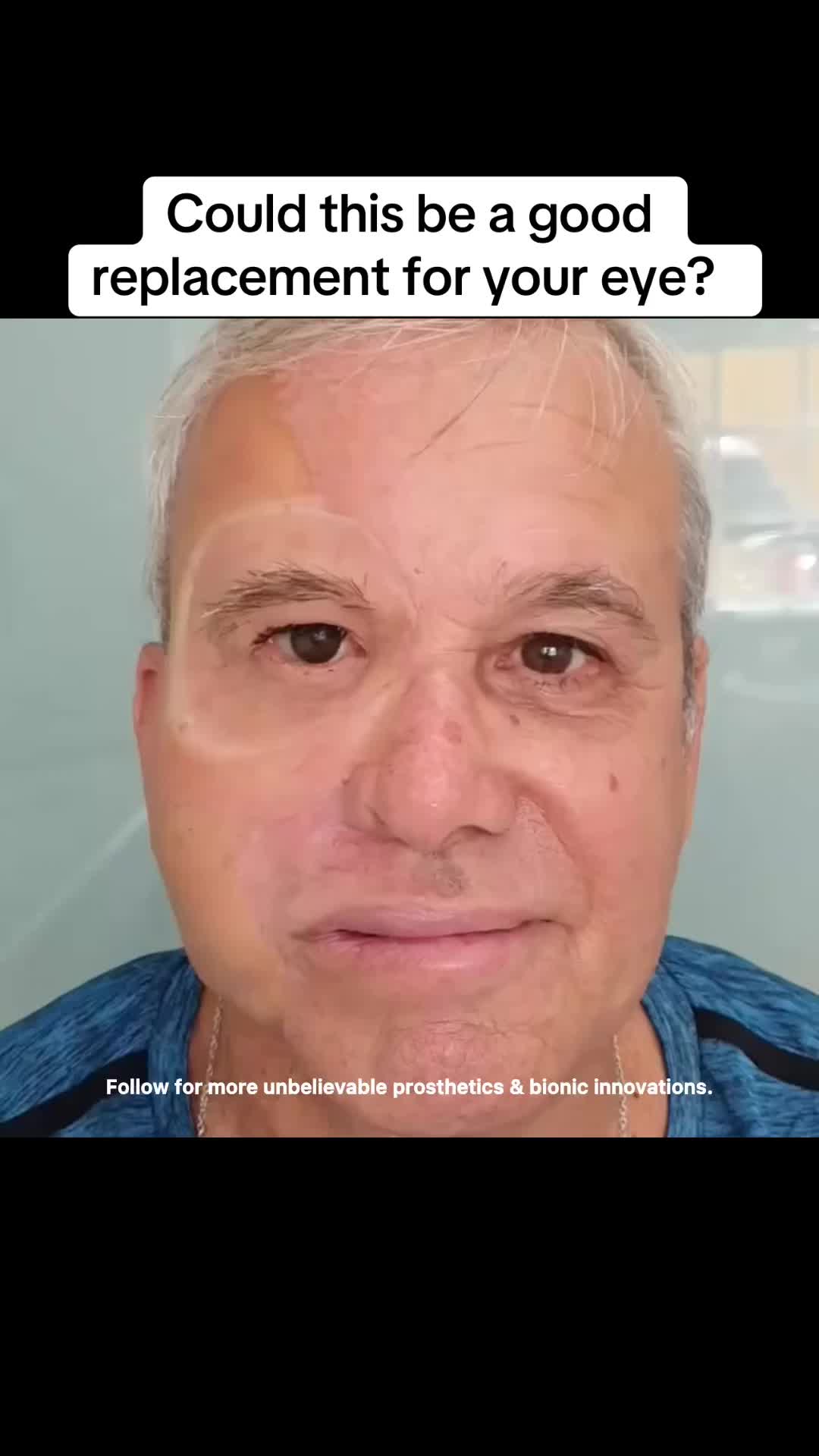 @bionic.future