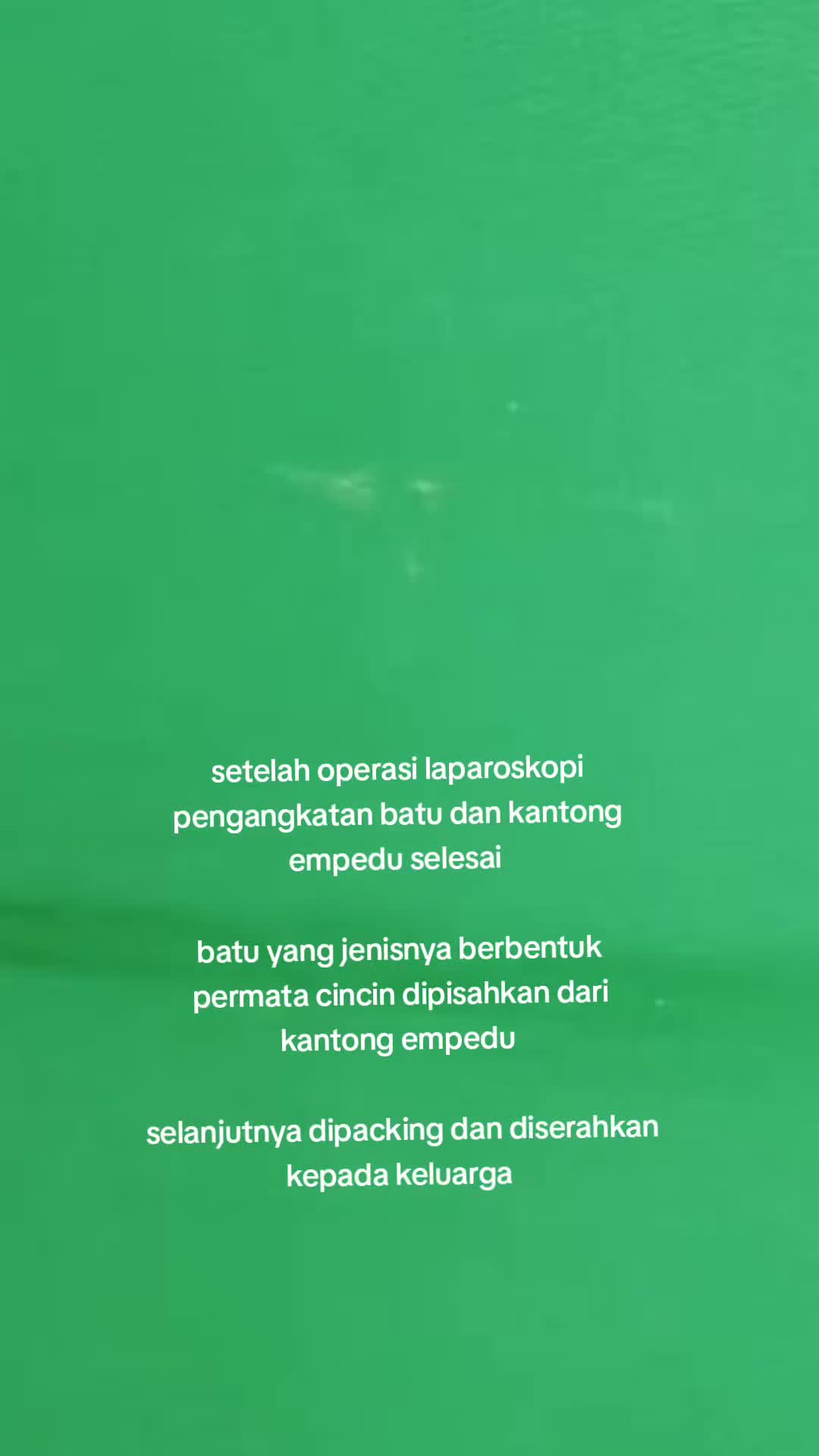 @KAMAR OPERASI