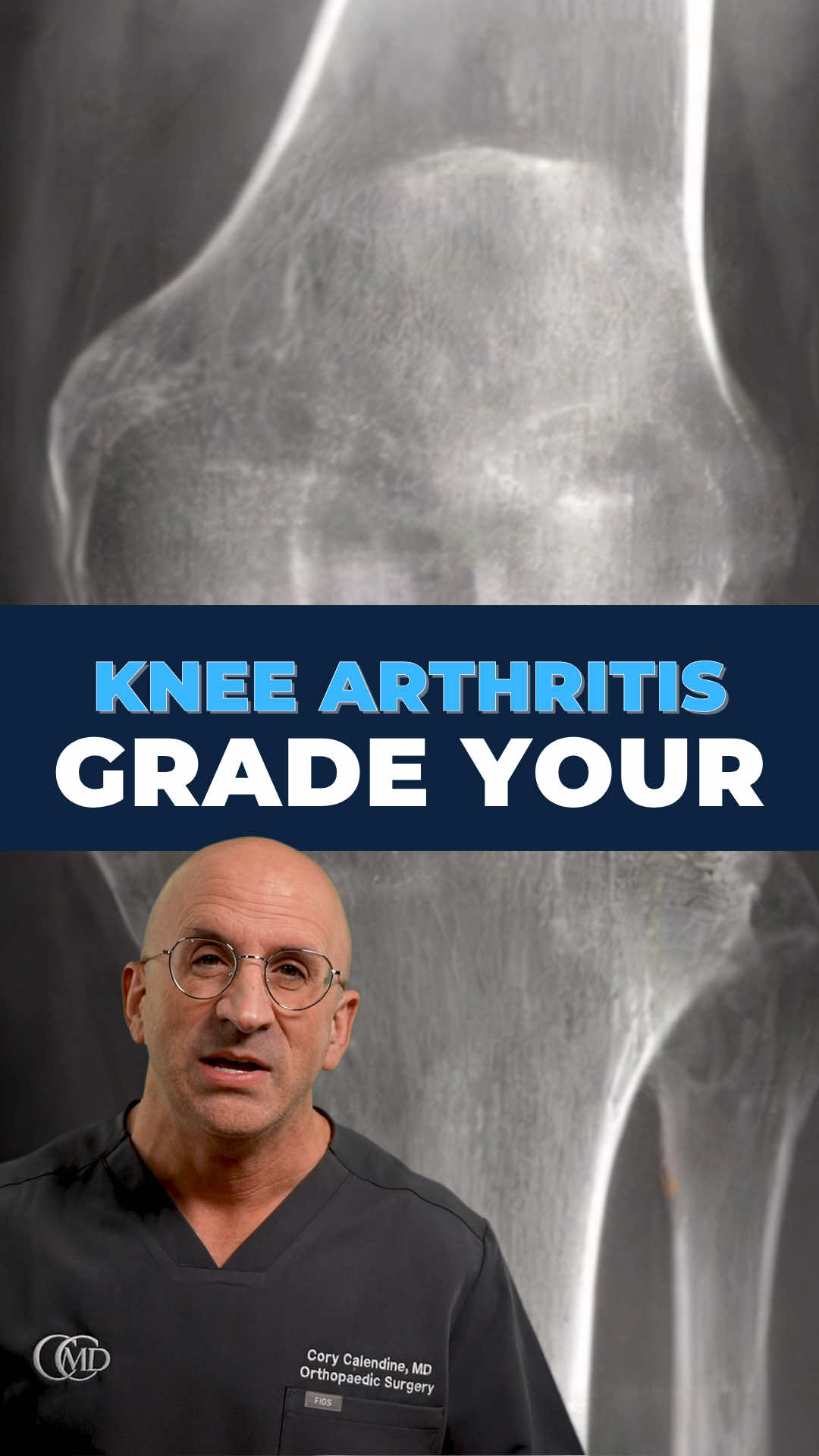 @Bone Doctor - Joint Pain MD