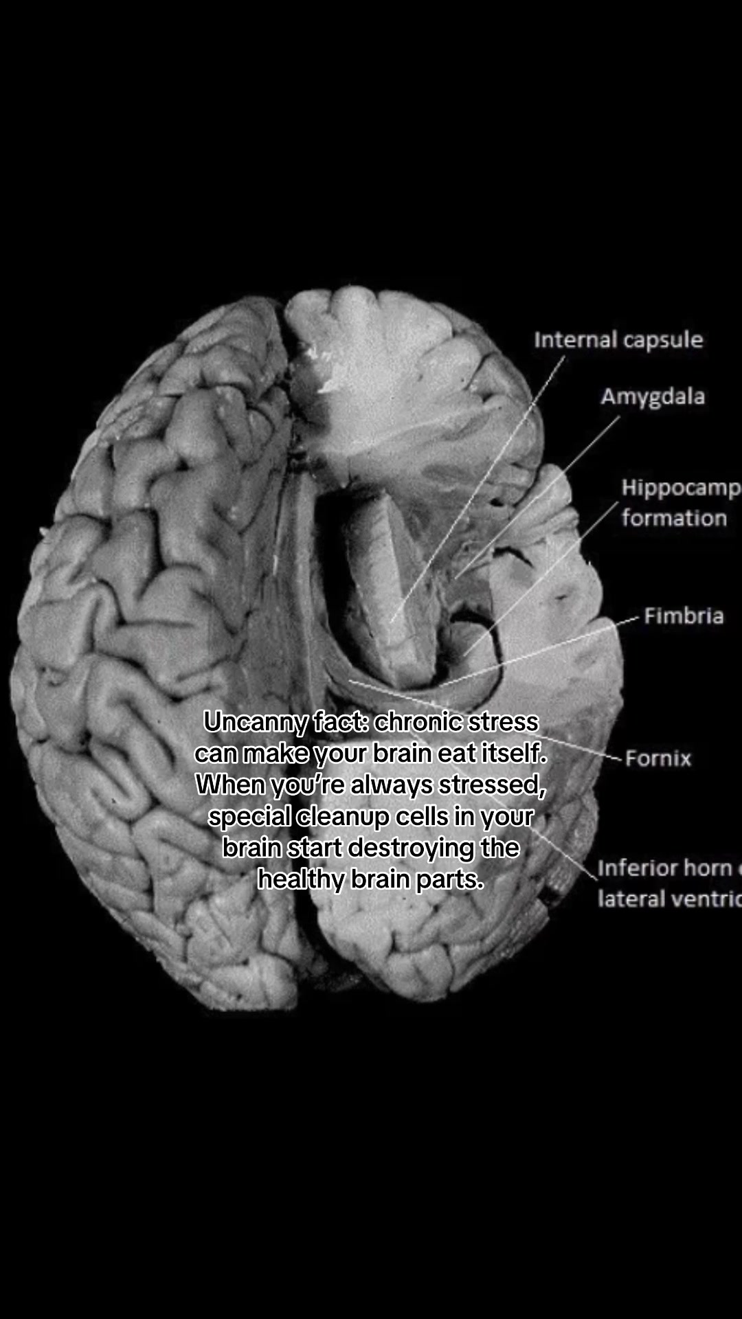 @Brainstormed
