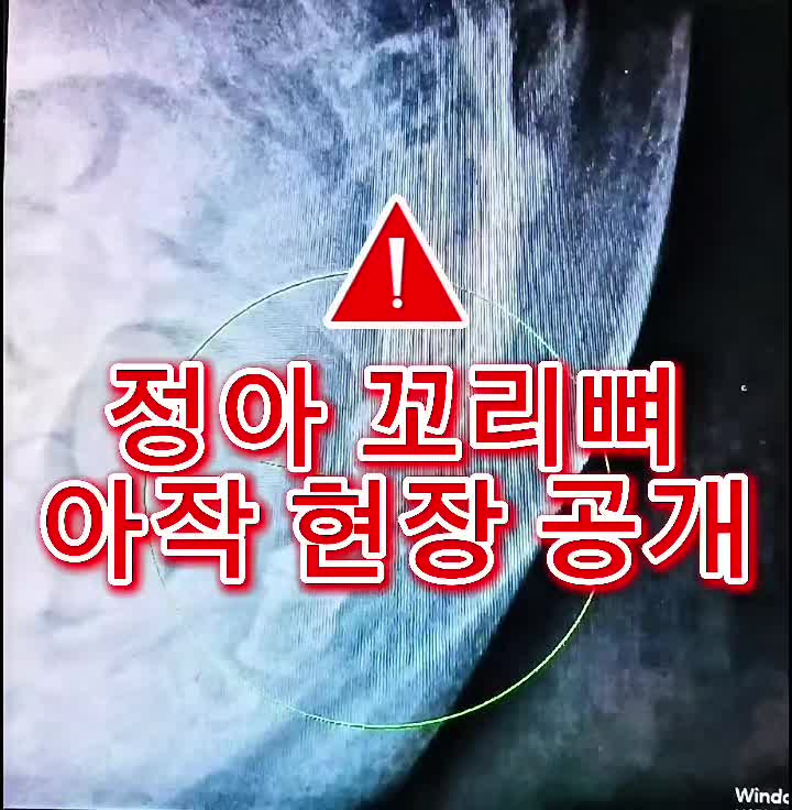 @๐ช์ ์๐ช