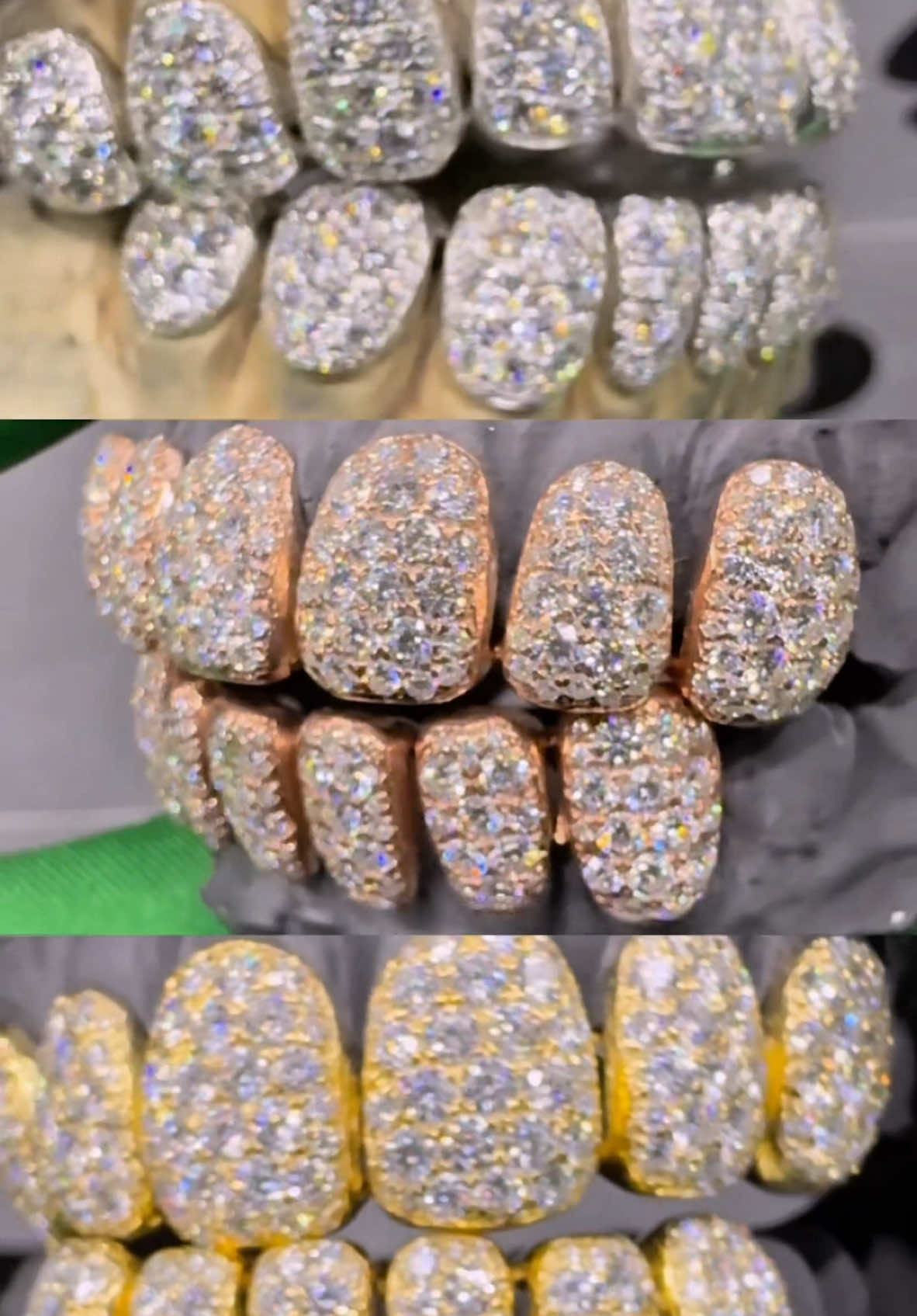 @GoldMoneyGrillz