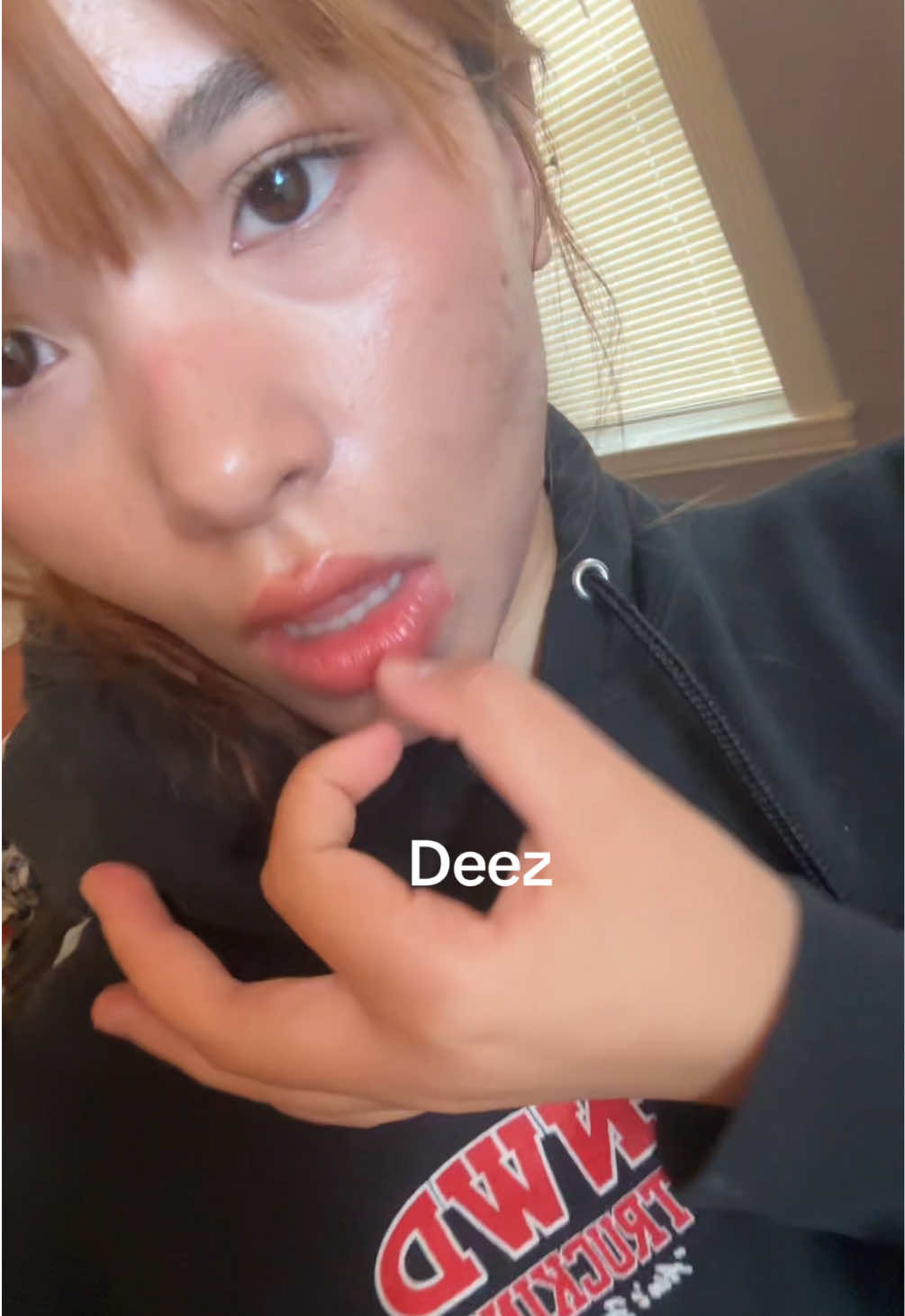 @juicedlimeade