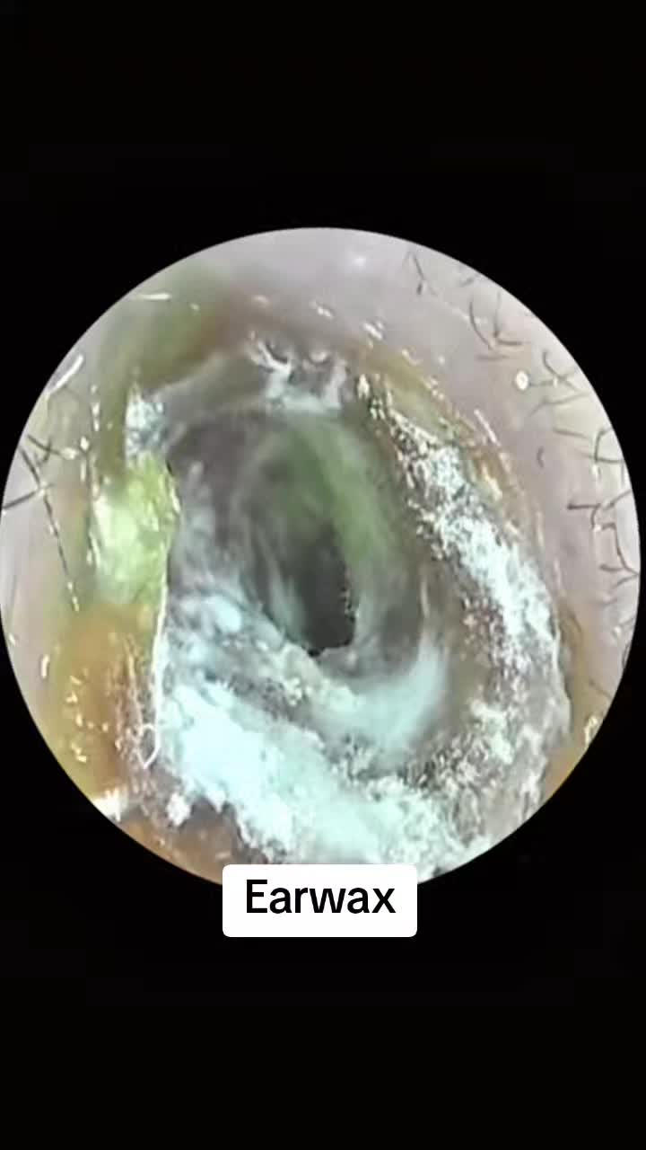 @Earwax.pro