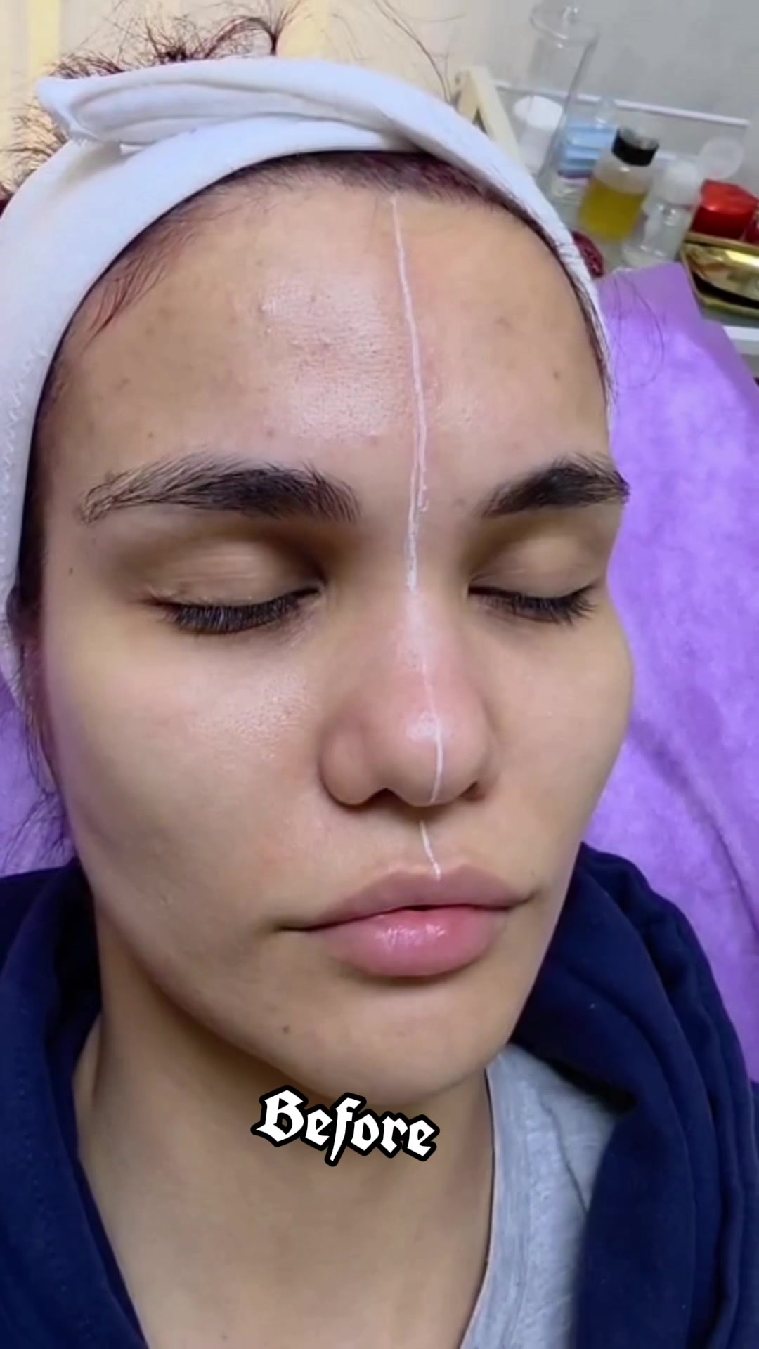 @cosmetolog.Ilaha🇹🇲🇦🇿