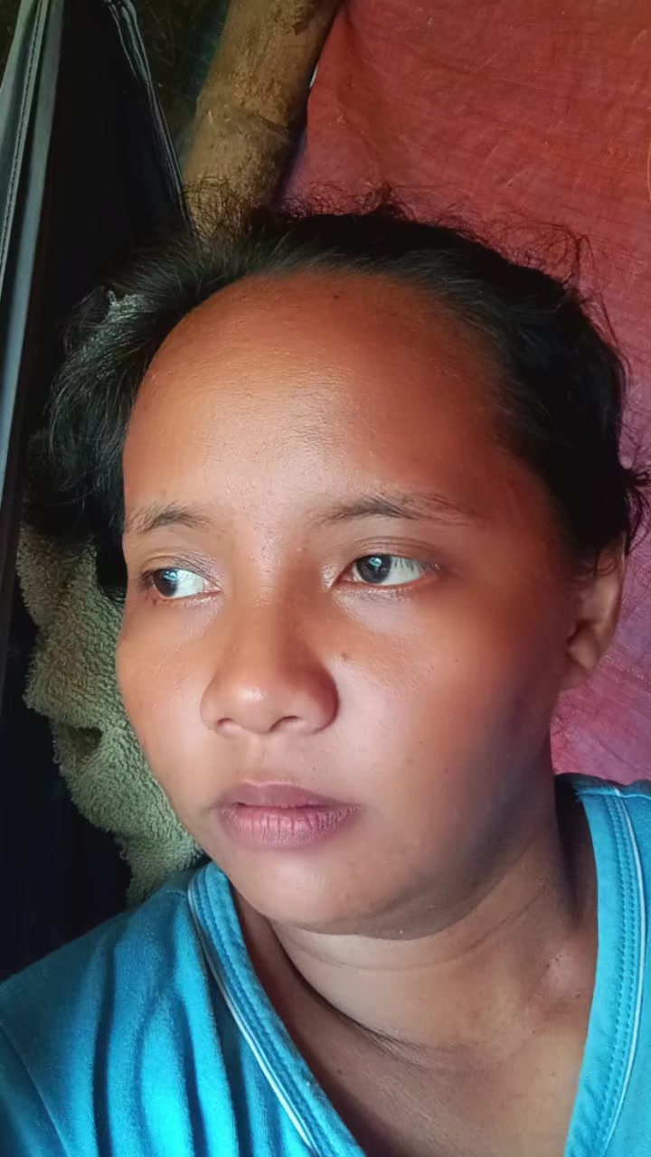 @bungal🤪✅