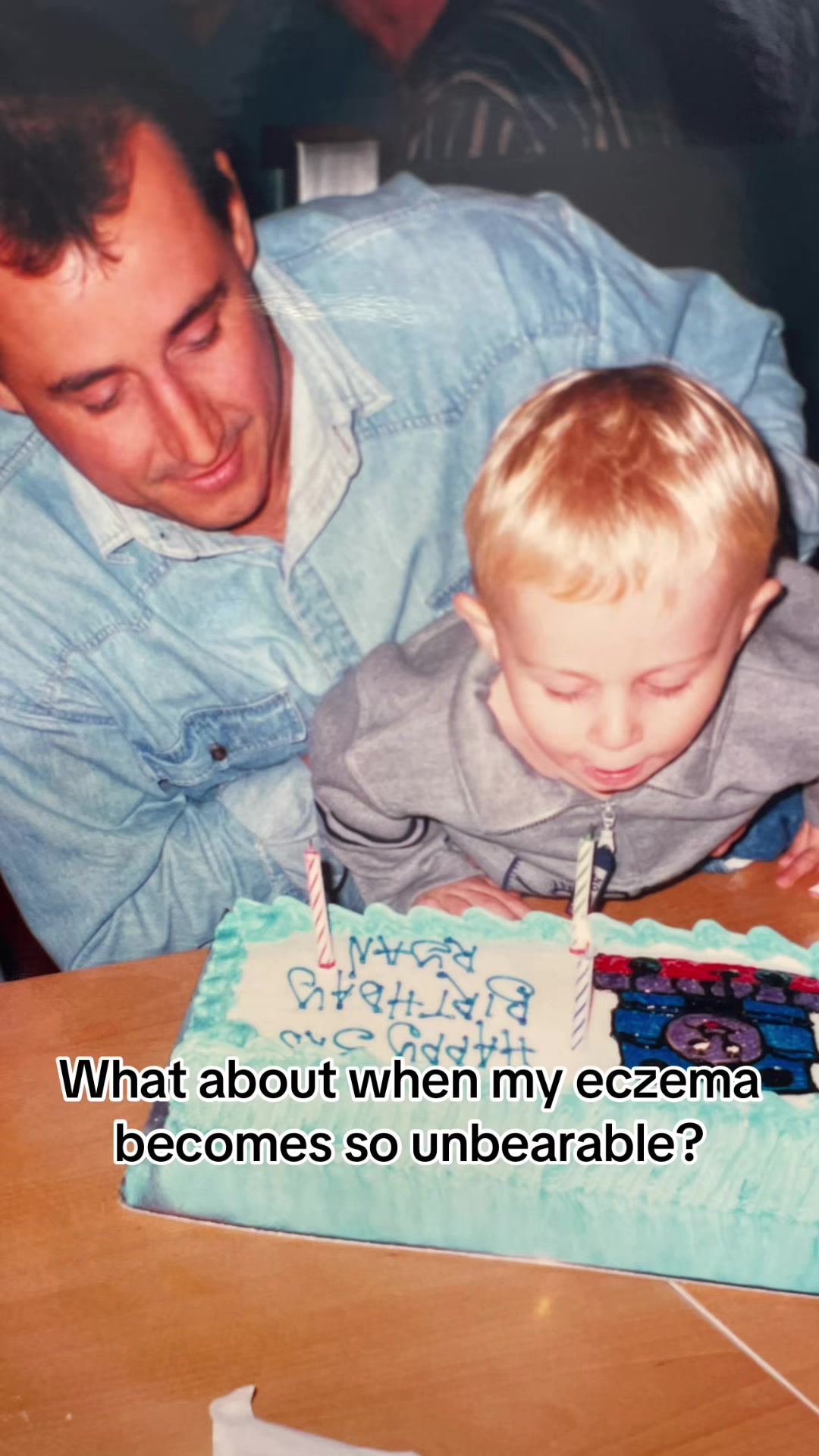 @Eczema Diaries USA & UK