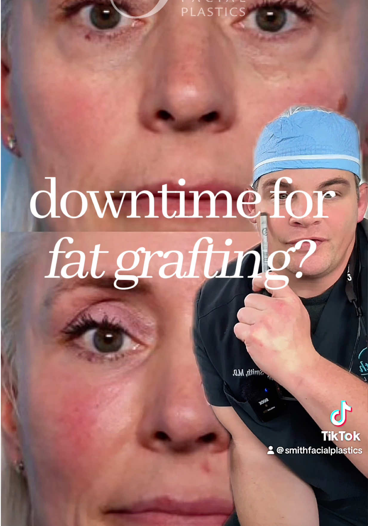 @Smith Facial Plastics