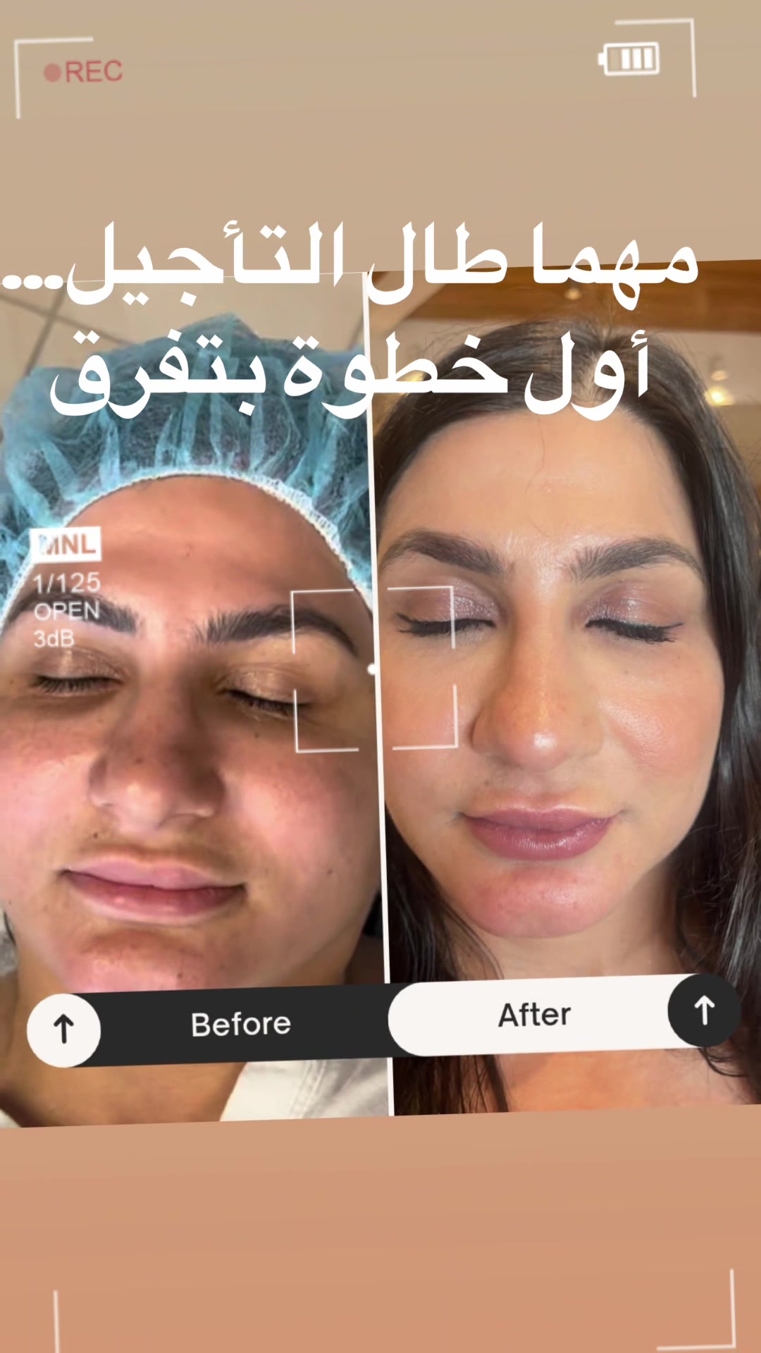 @Summer Skin Clinic | Toronto