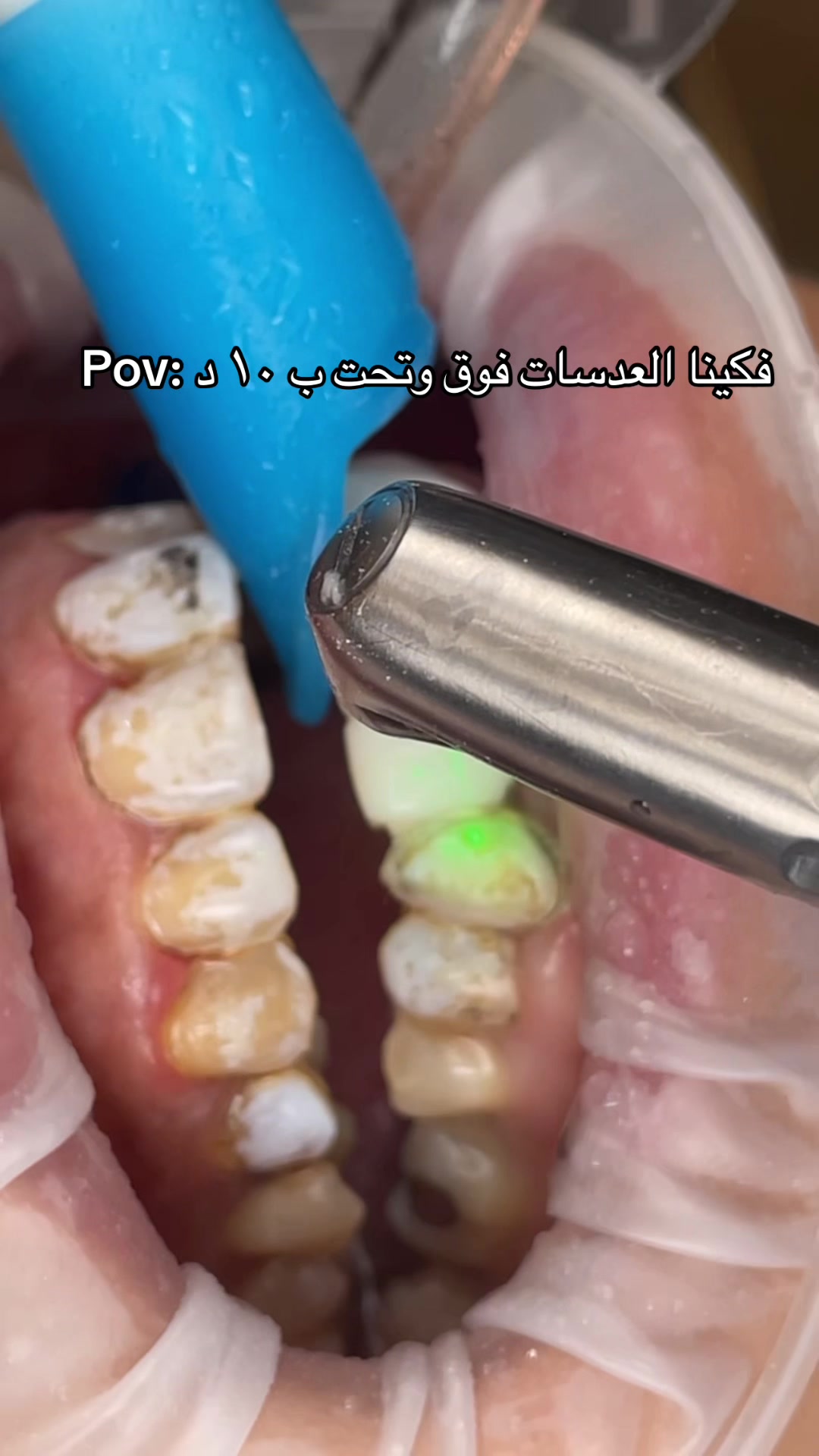 @Dr. Abrar Alhababi