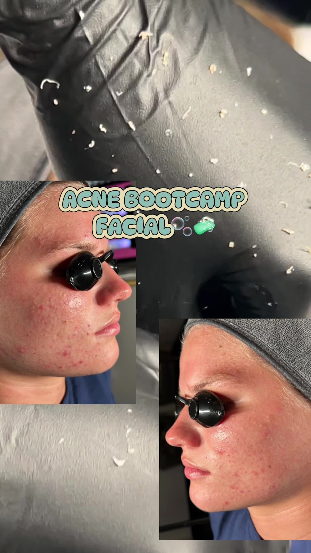 @alaina | FL esthetician