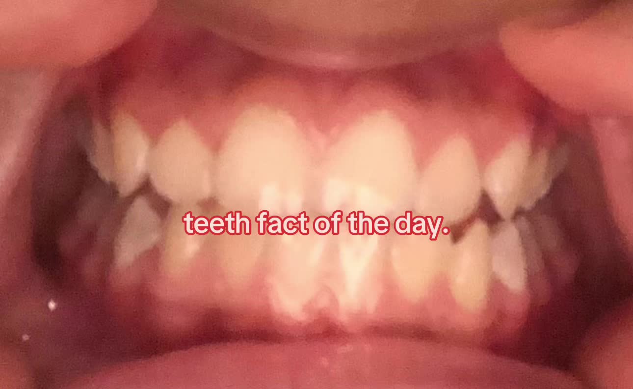 @I leik teeth moer thna mysefl.