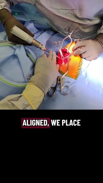 @Ortho POV