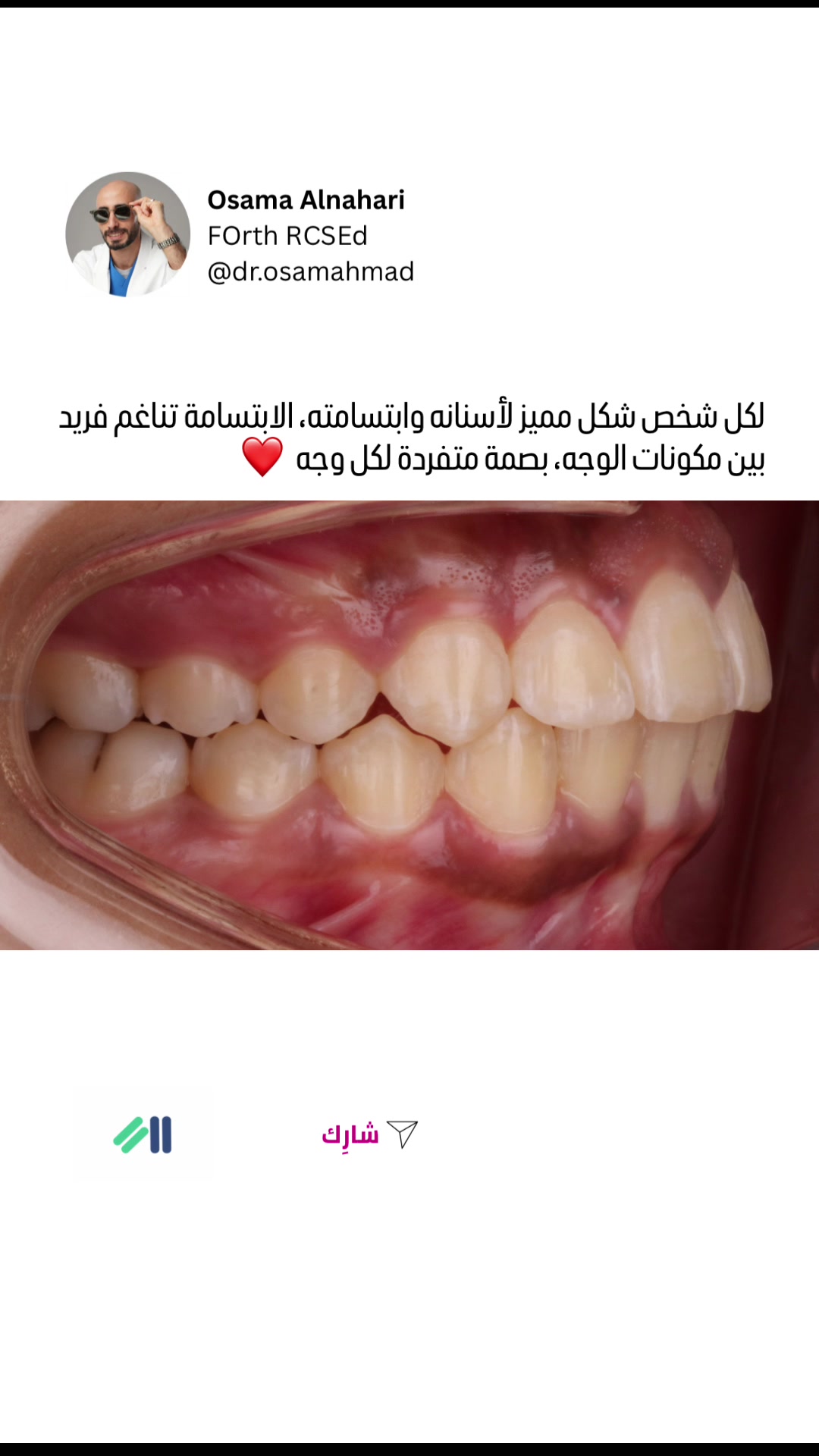 @د. أسامة أحمد | تقويم أسنان