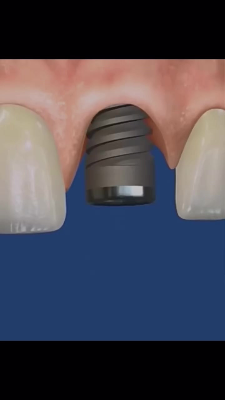 @Dent_tooth