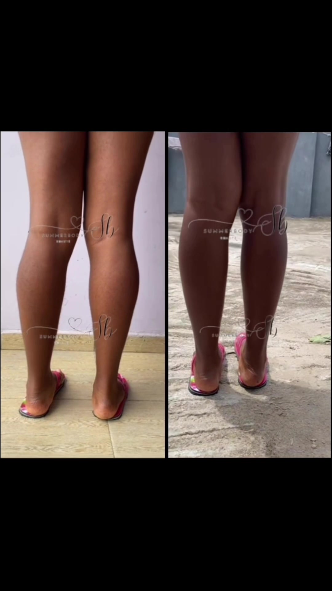 @summerbody