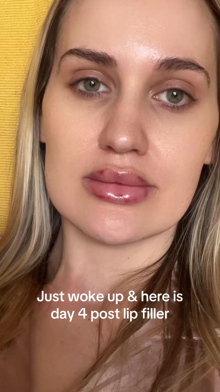 @Simonevanwyk