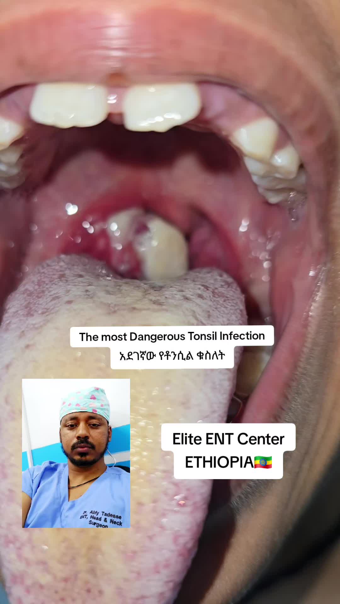 @ዶ/ር ዐብይ ታደሰ (ENT&HN surgeon)
