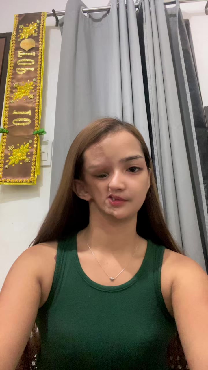 @Charene Treso