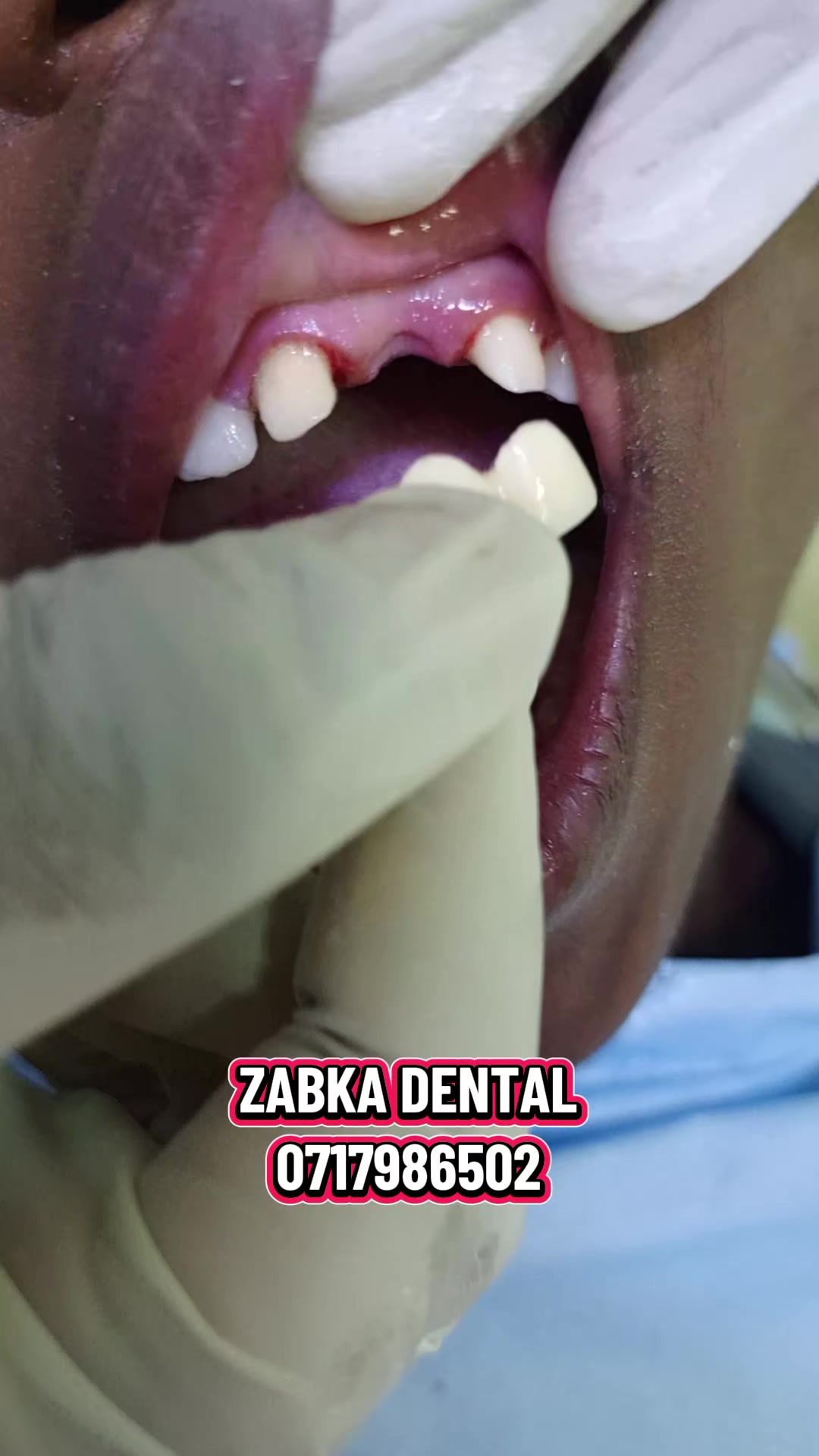 @Zabka Dental