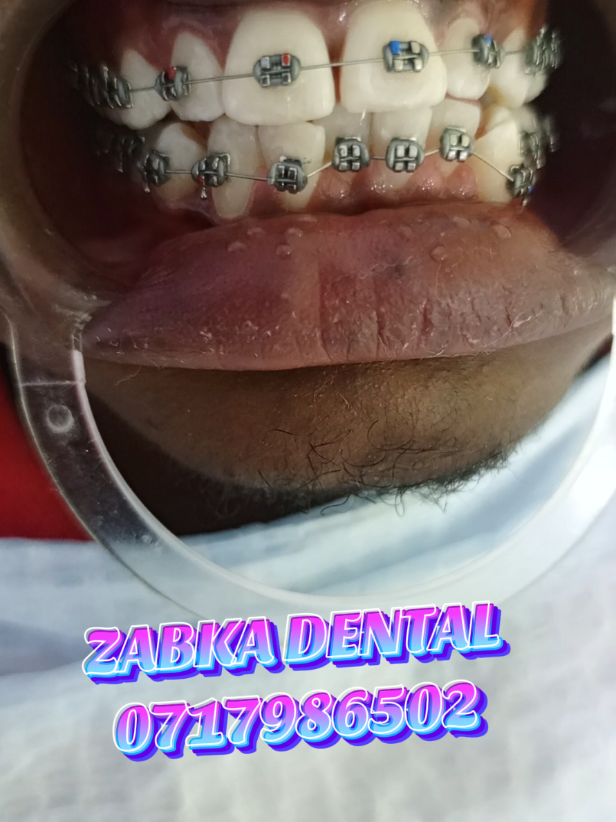 @Zabka Dental