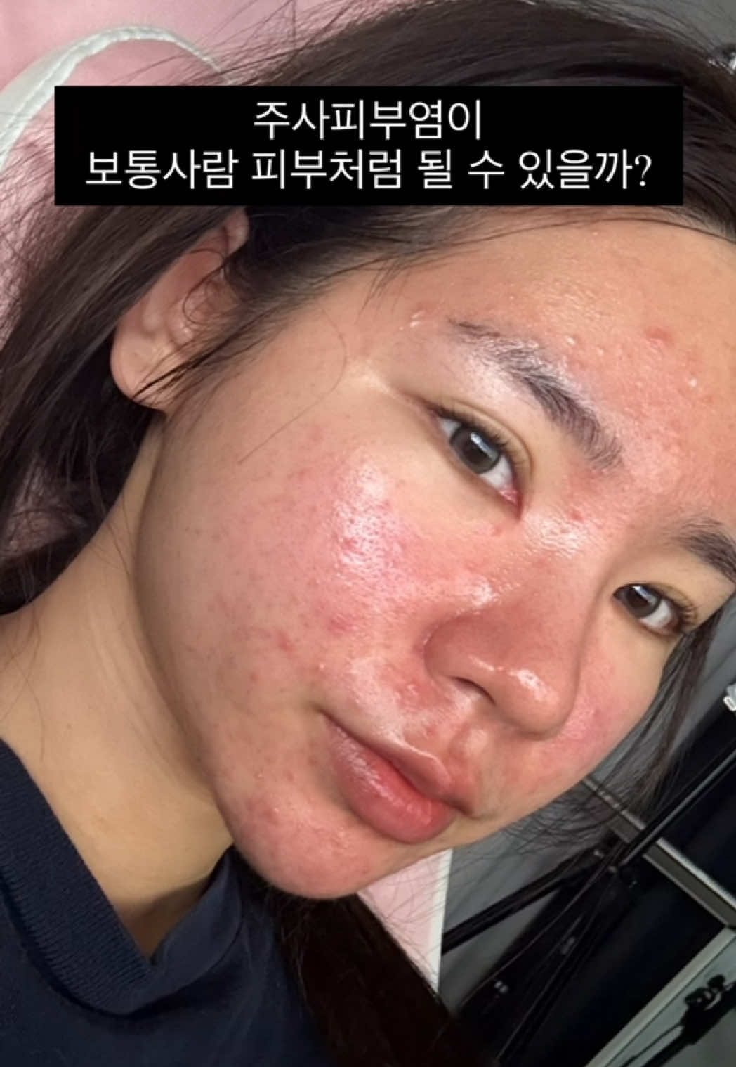 @박봉팔
