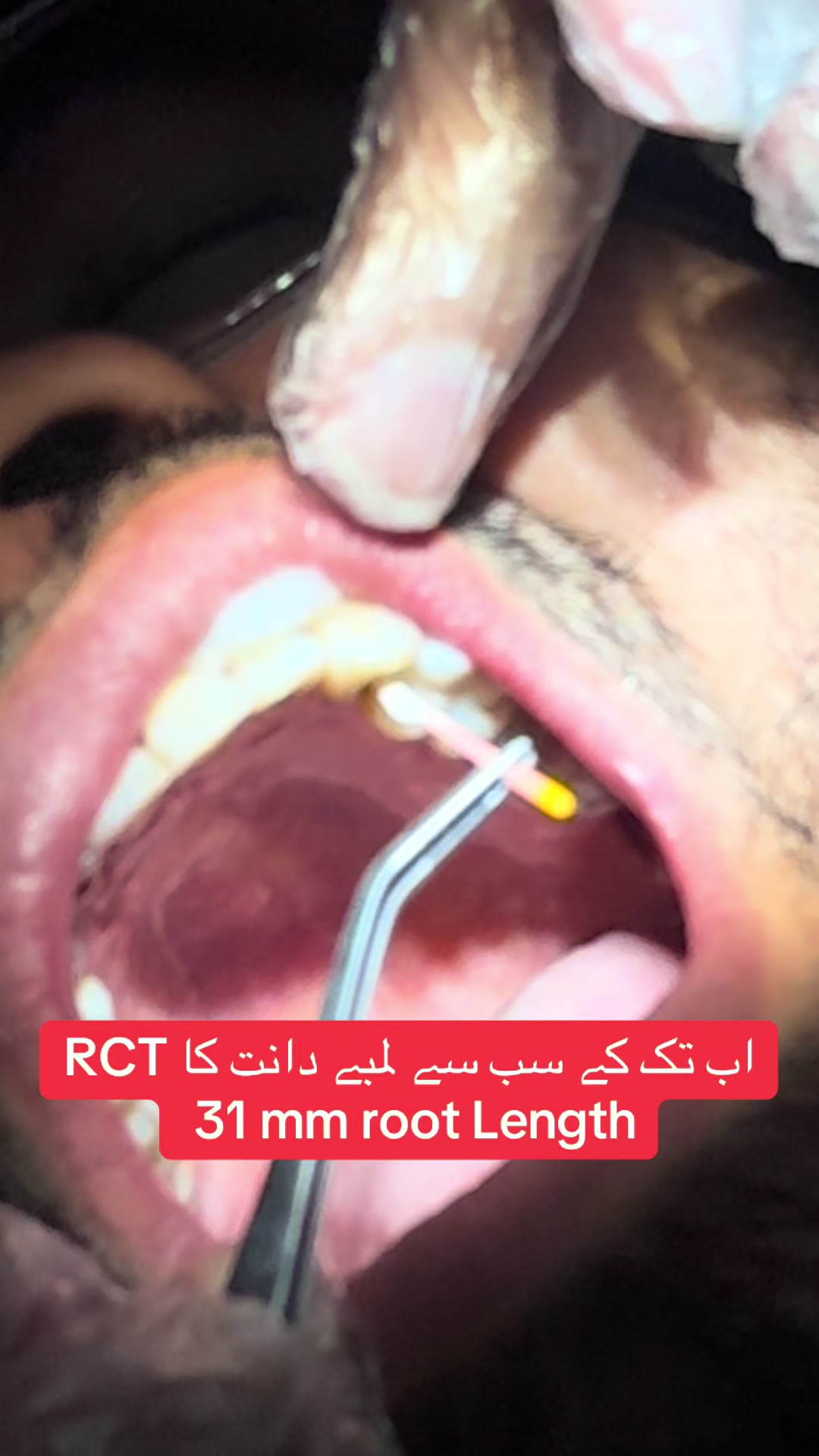 @Dr Hammad| Dental Surgeon