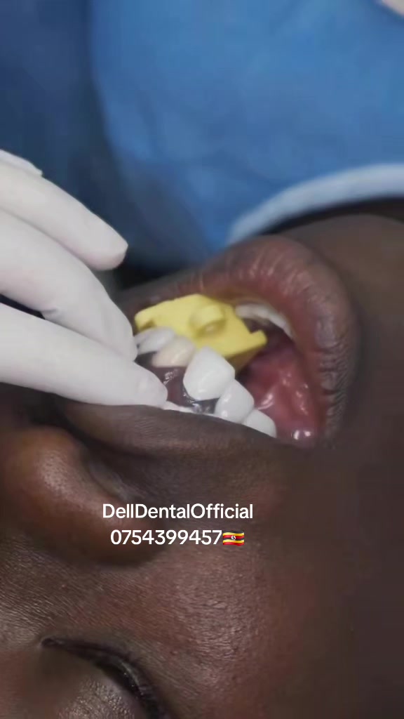 @DellDentalOfficial