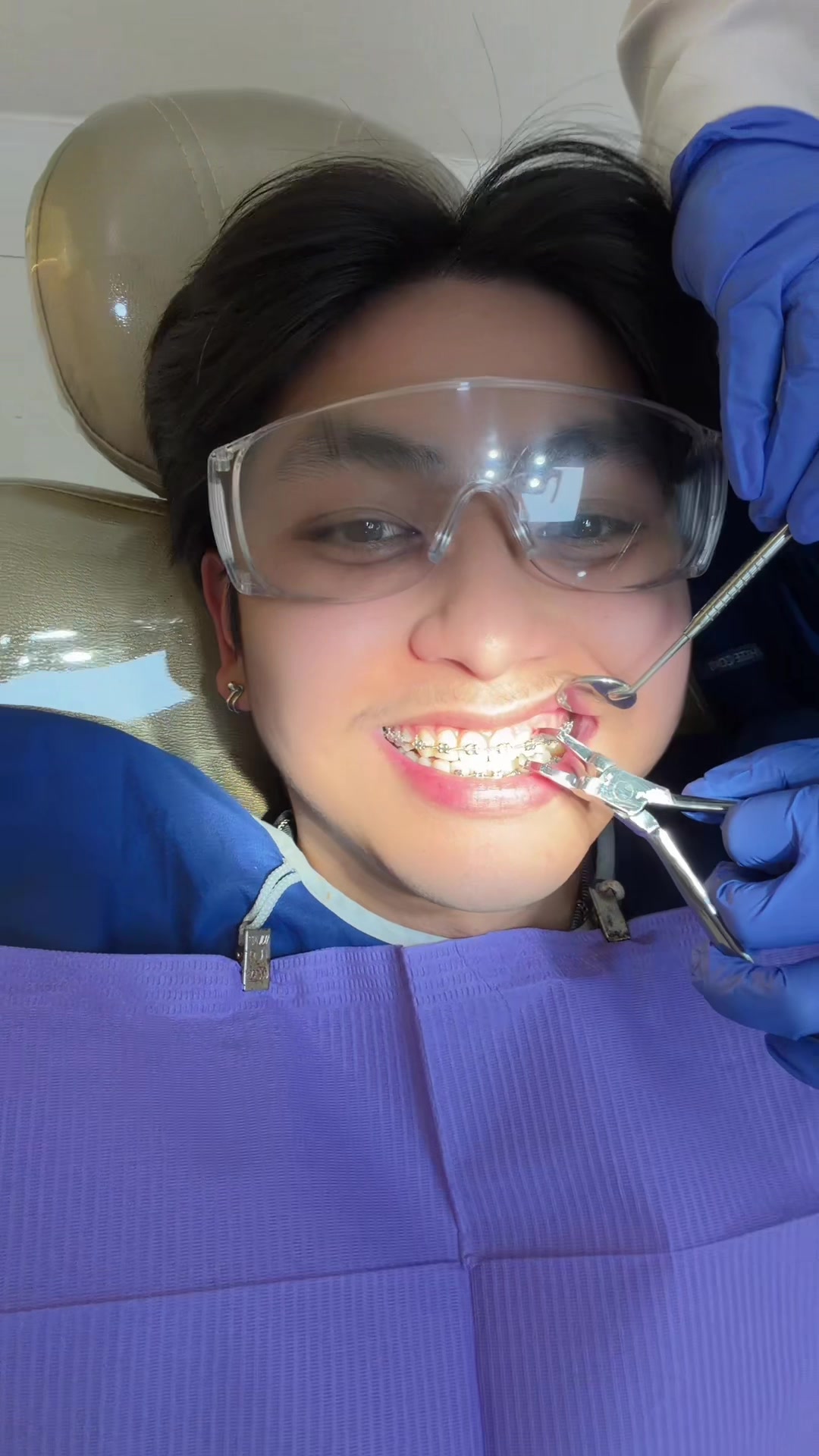 @Franz Miaco