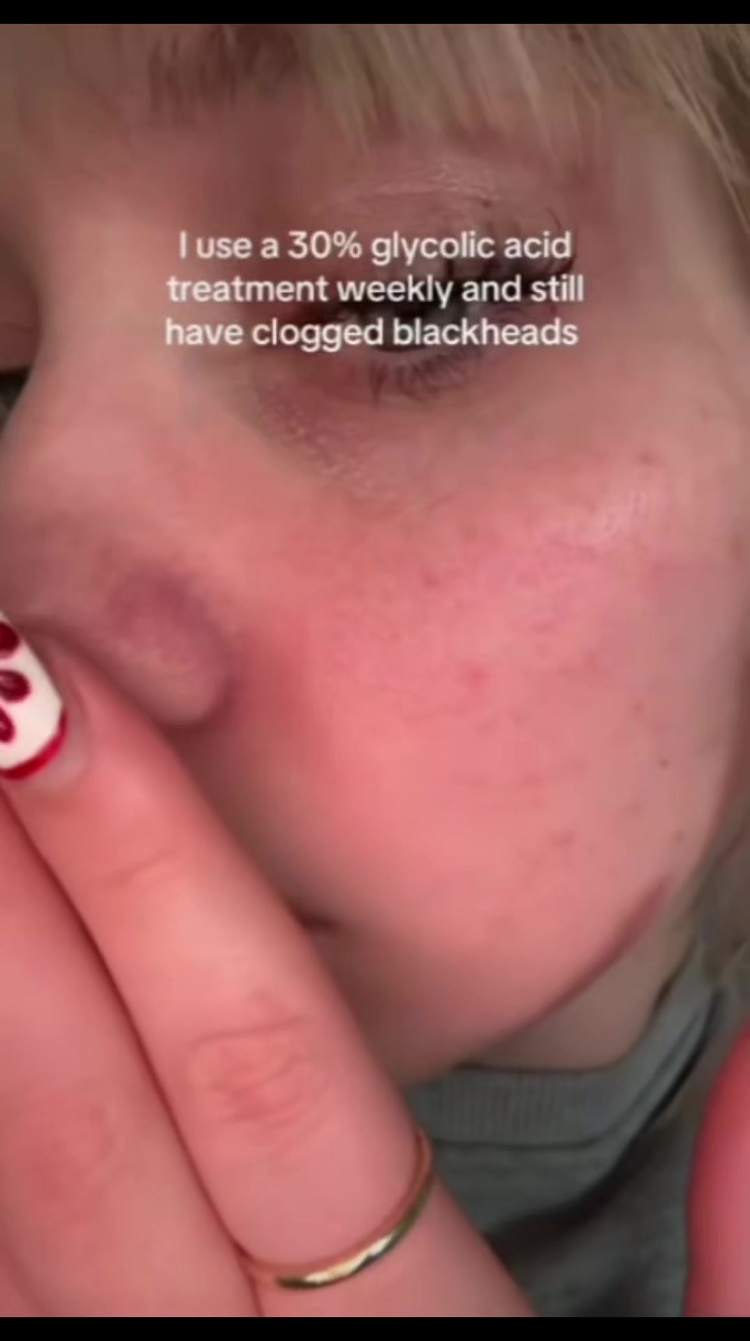 @Pure Skin OC